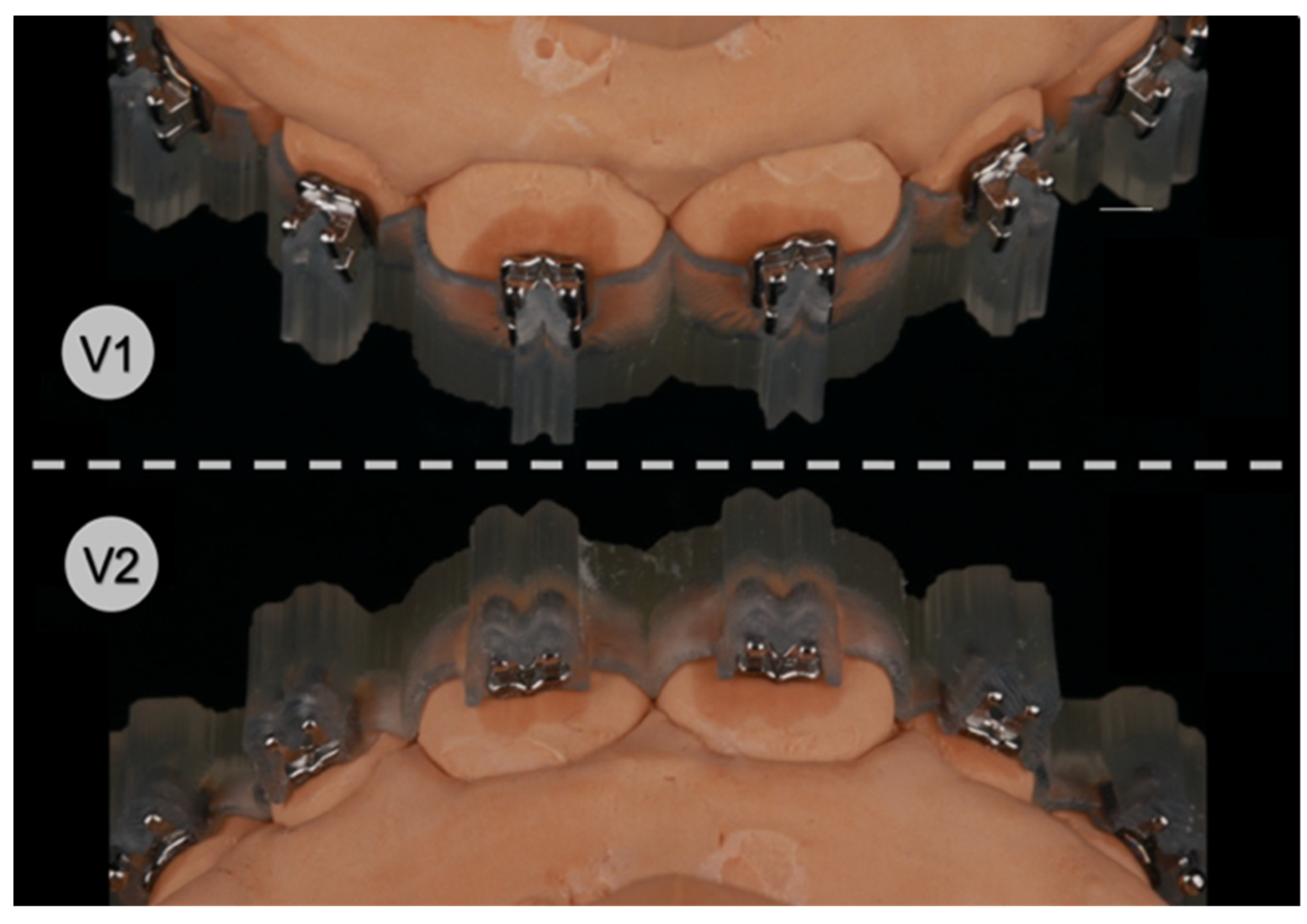 Orthodontic O-hook (10 pcs) - SCHEU-DENTAL