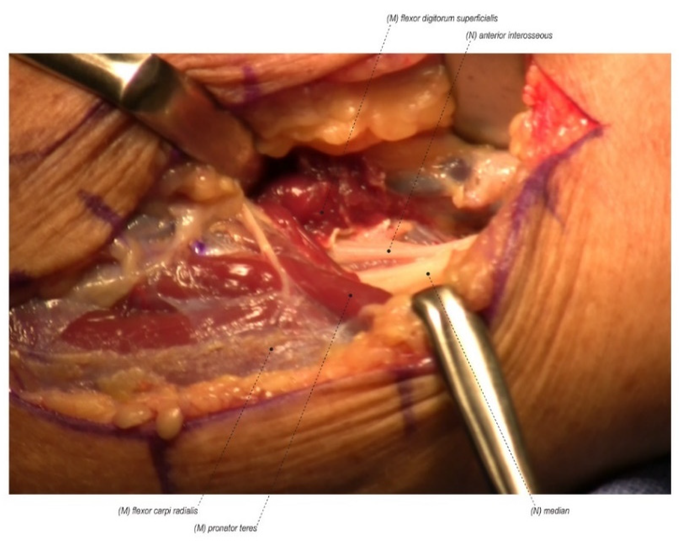 Jcm 11 01386 g002 Jcm 11 01386 g002
