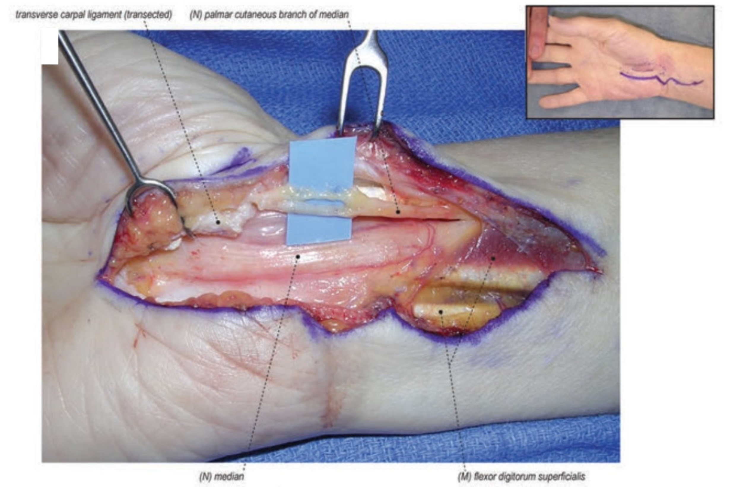 Jcm 11 01386 g005 Jcm 11 01386 g005