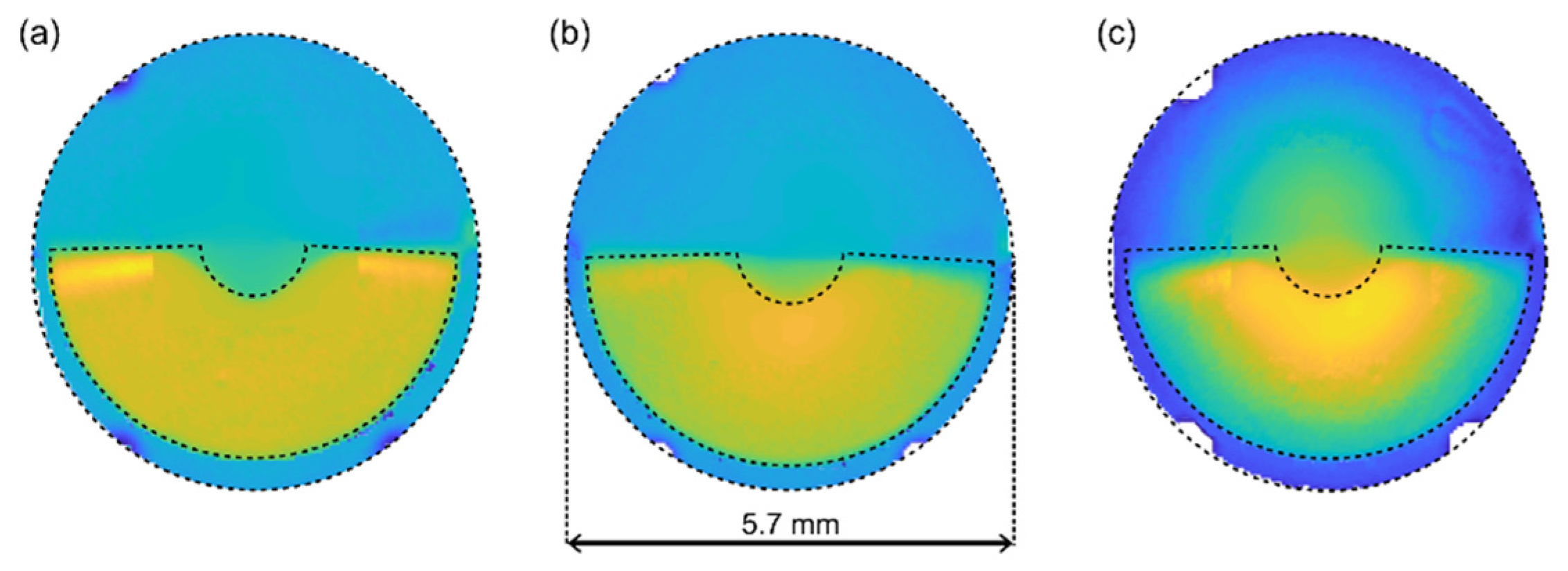 JCM | Free Full-Text | Polychromatic Assessment of a Refractive Segmented  EDOF Intraocular Lens