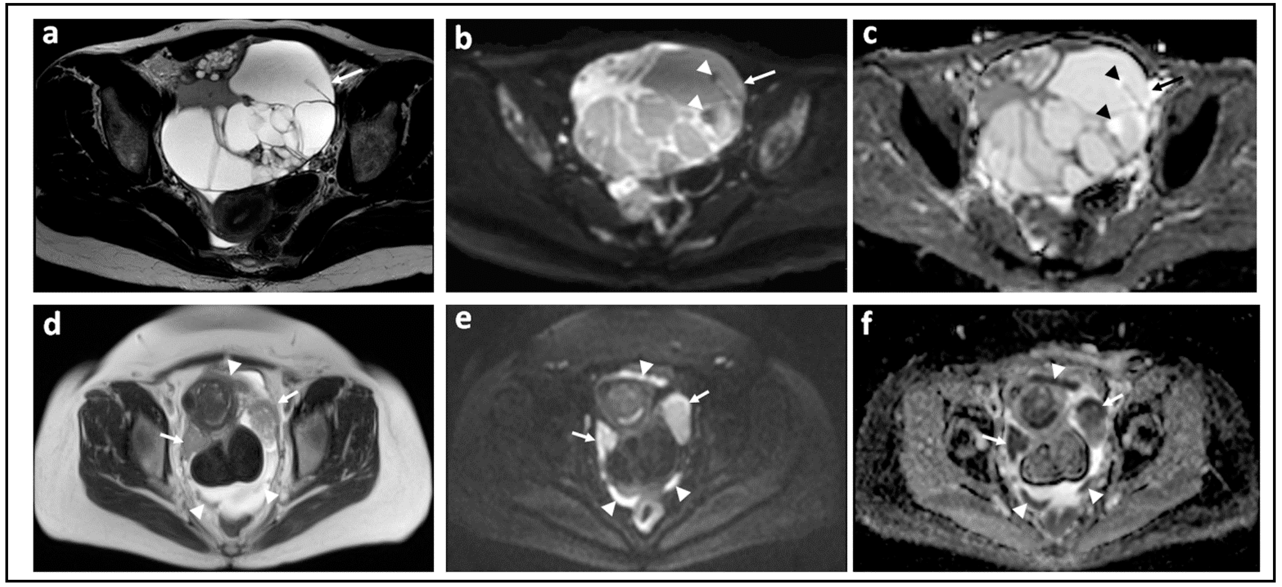 jcm-free-full-text-diffusion-weighted-magnetic-resonance-imaging-in