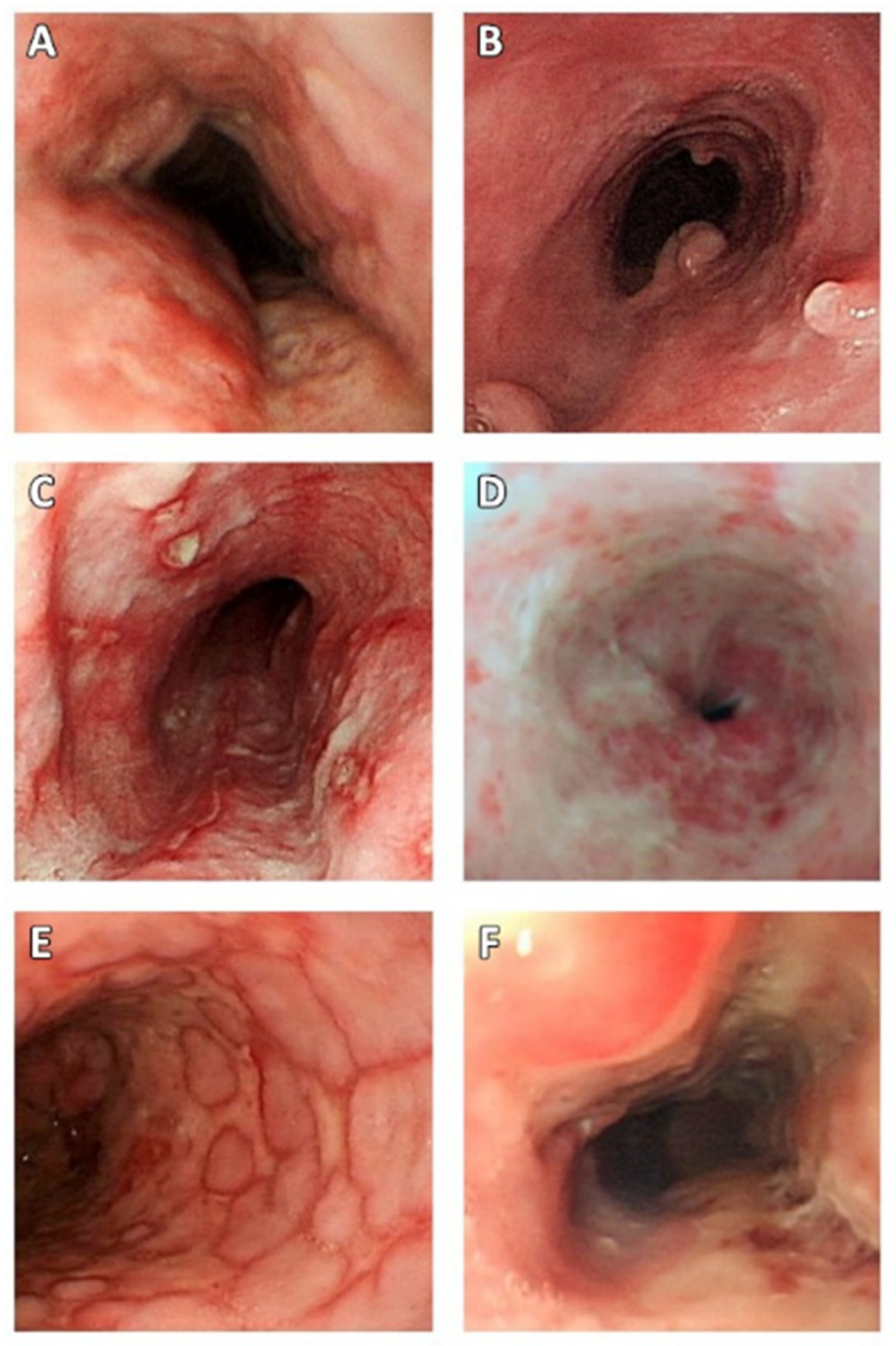 Jcm 11 01583 g002 Jcm 11 01583 g002