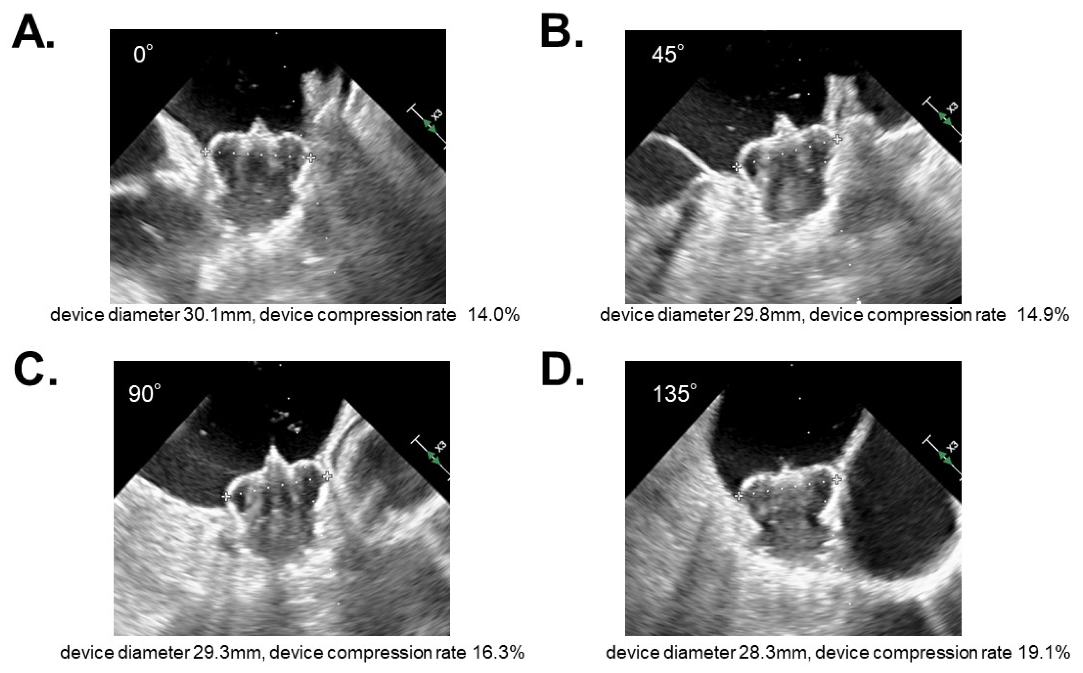 JCM Free FullText Comparison in ShortTerm Safety and Efficacy