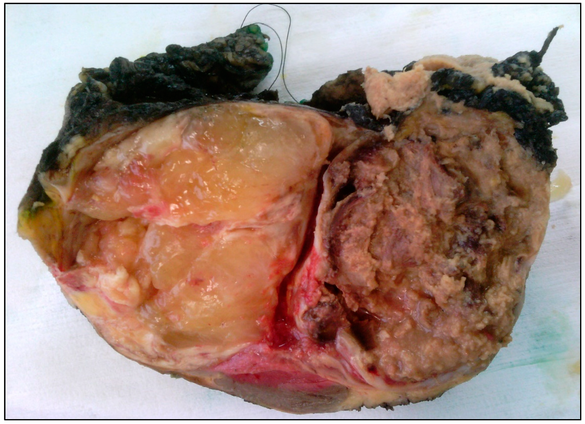 Jcm 11 01938 g002 Jcm 11 01938 g002