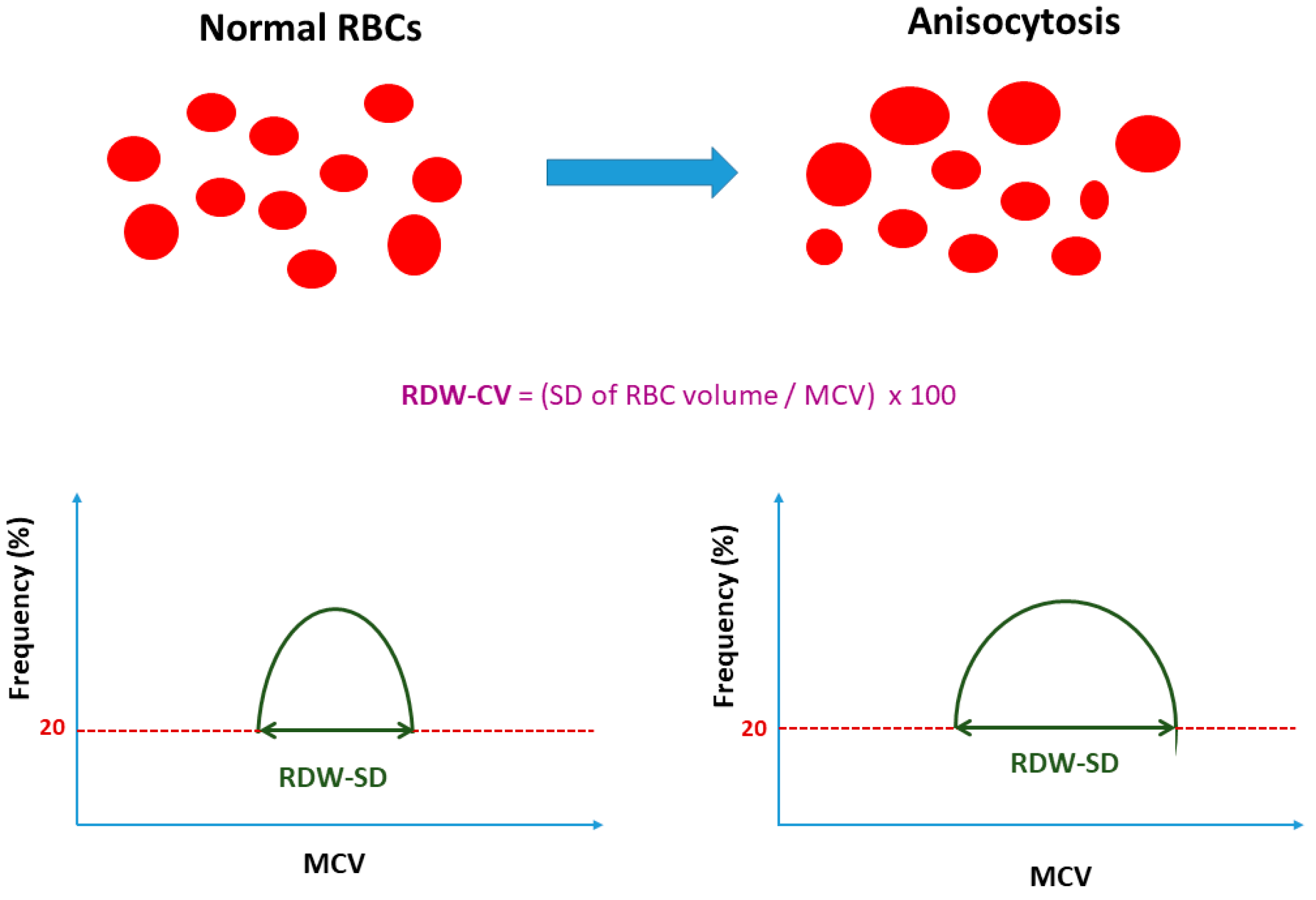 JCM | Free Full-Text | Red Blood Cell Distribution Width in Heart Failure:  Pathophysiology, Prognostic Role, Controversies and Dilemmas