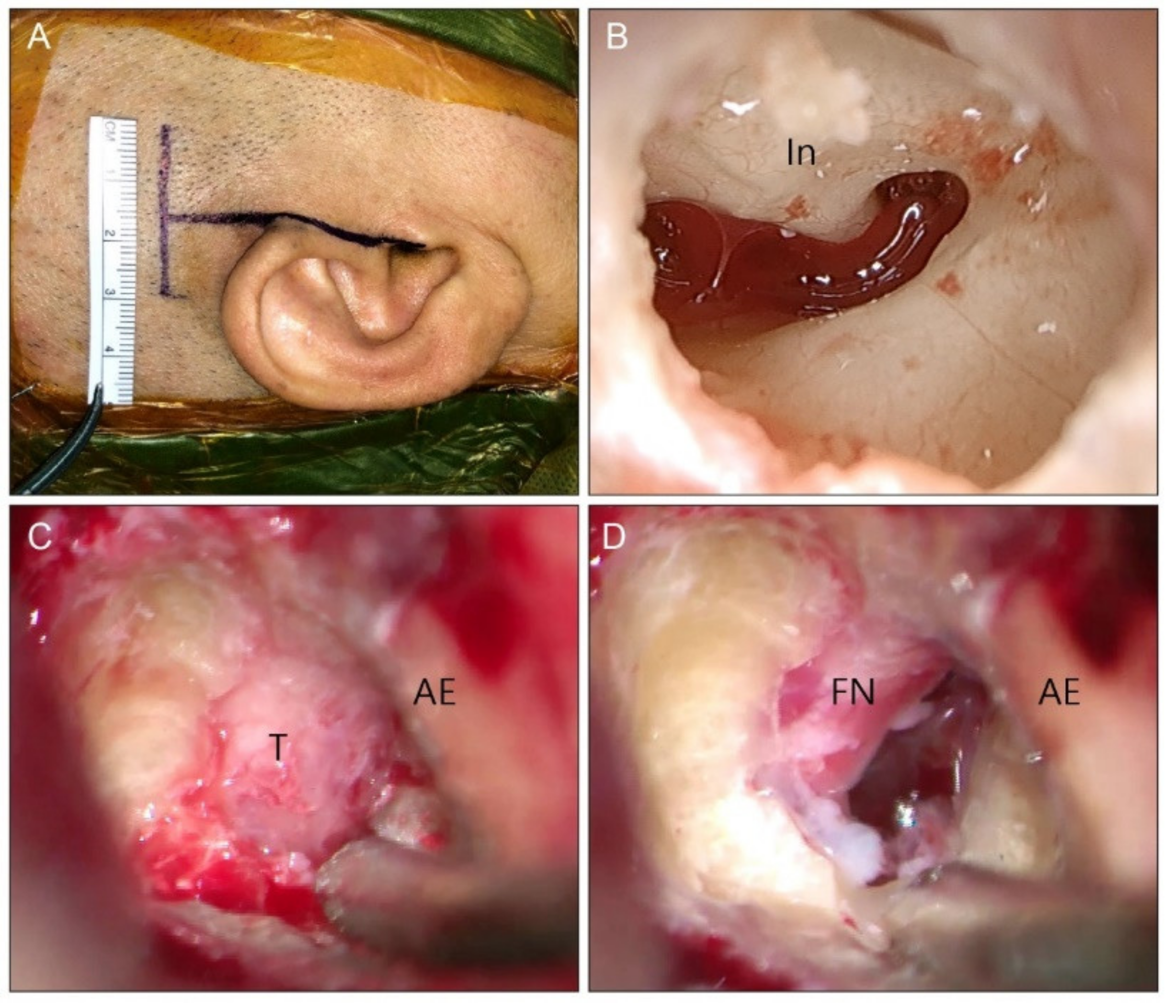 Jcm 11 02324 g003 Jcm 11 02324 g003