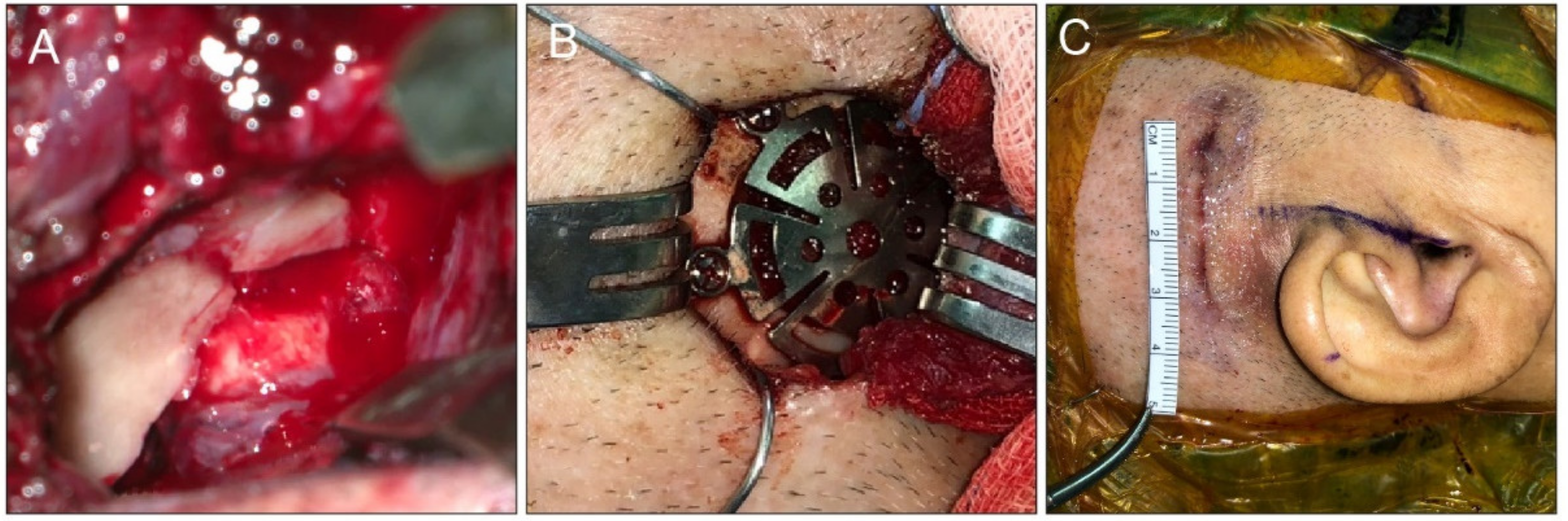 Jcm 11 02324 g004 Jcm 11 02324 g004