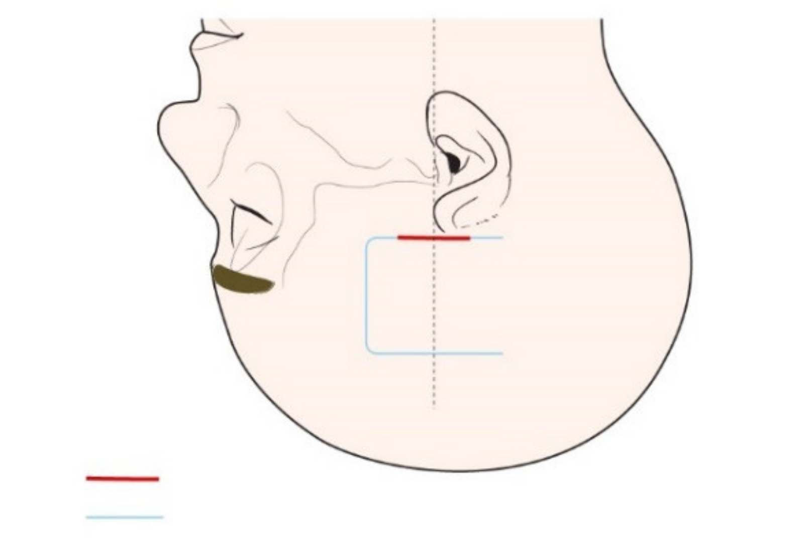 Jcm 11 02324 g005 Jcm 11 02324 g005