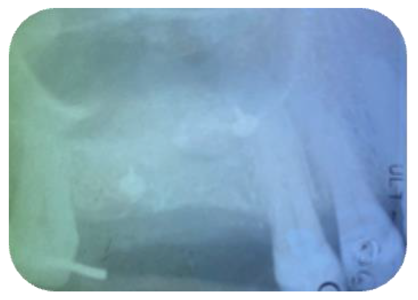 Jcm 11 02491 g005 Jcm 11 02491 g005