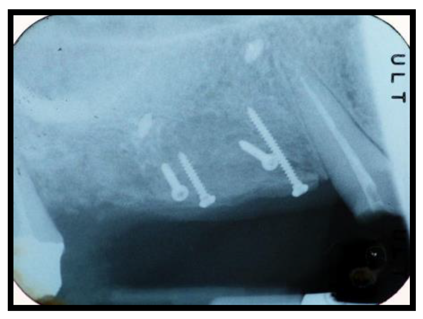 Jcm 11 02491 g006 Jcm 11 02491 g006