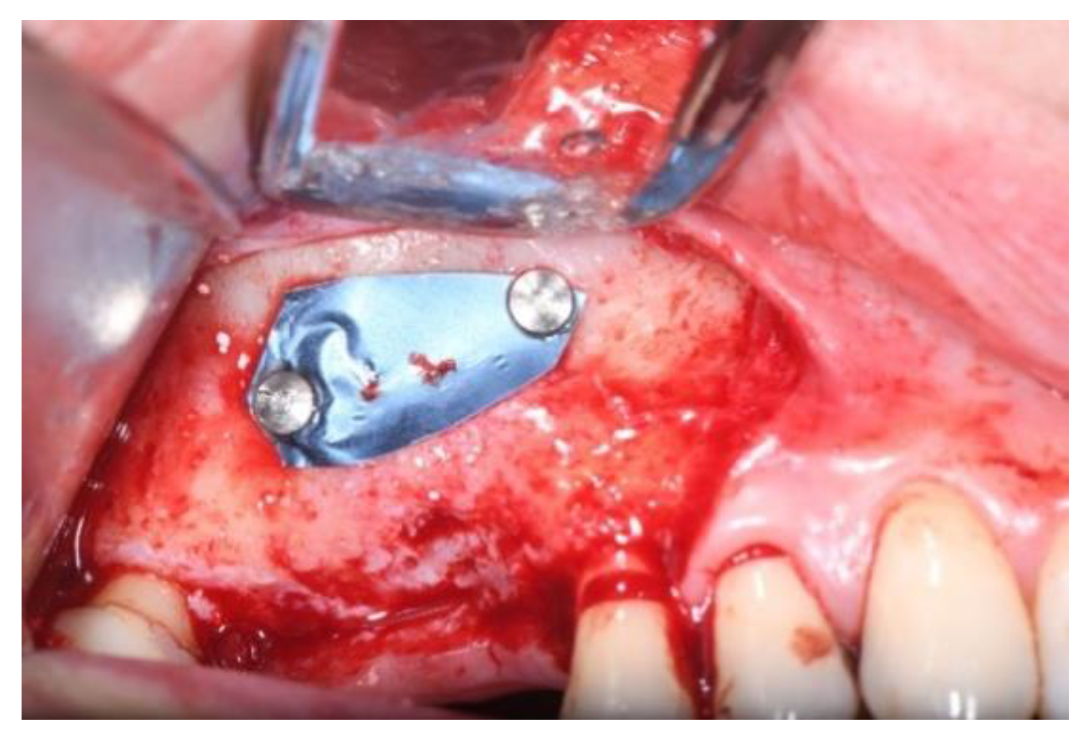 Jcm 11 02491 g007 Jcm 11 02491 g007