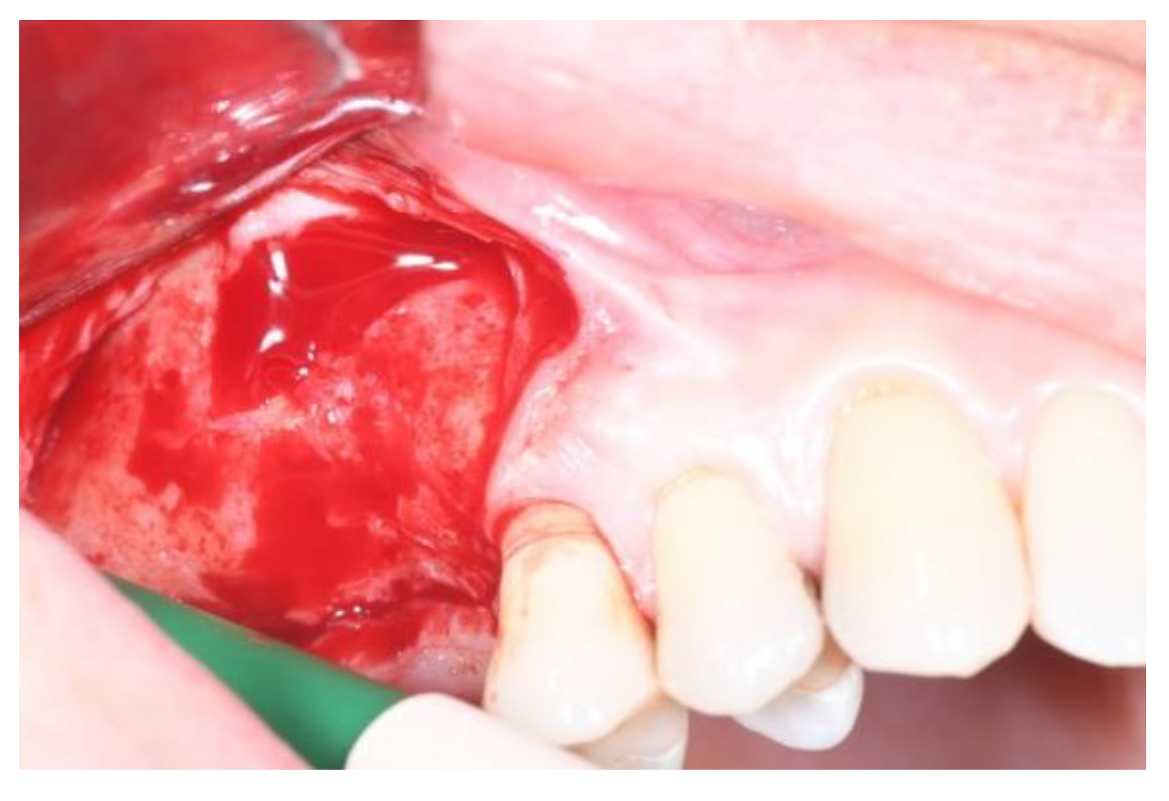 Jcm 11 02491 g009 Jcm 11 02491 g009