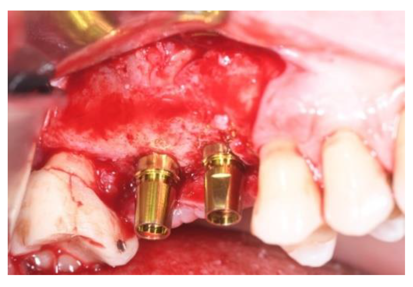 Jcm 11 02491 g011 Jcm 11 02491 g011