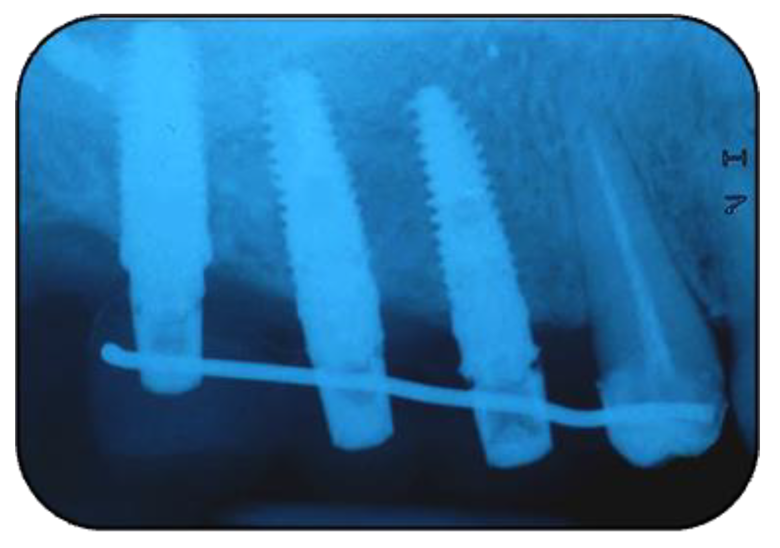 Jcm 11 02491 g014 Jcm 11 02491 g014