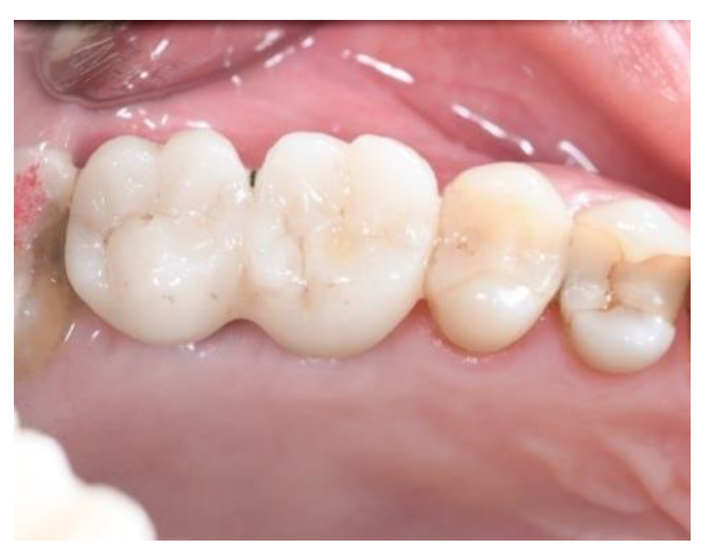 Jcm 11 02491 g015 Jcm 11 02491 g015