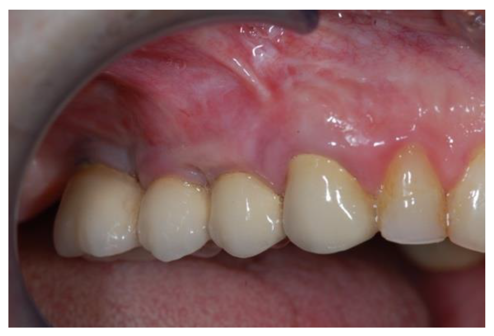 Jcm 11 02491 g016 Jcm 11 02491 g016