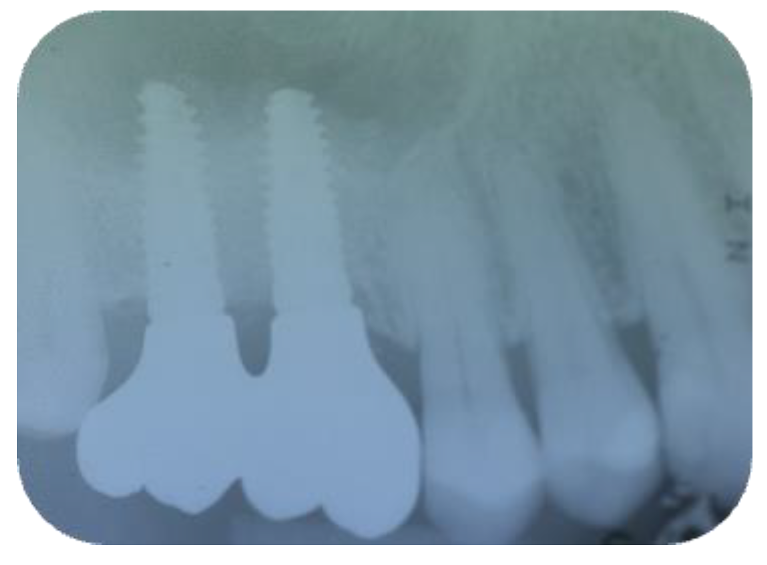 Jcm 11 02491 g019 Jcm 11 02491 g019