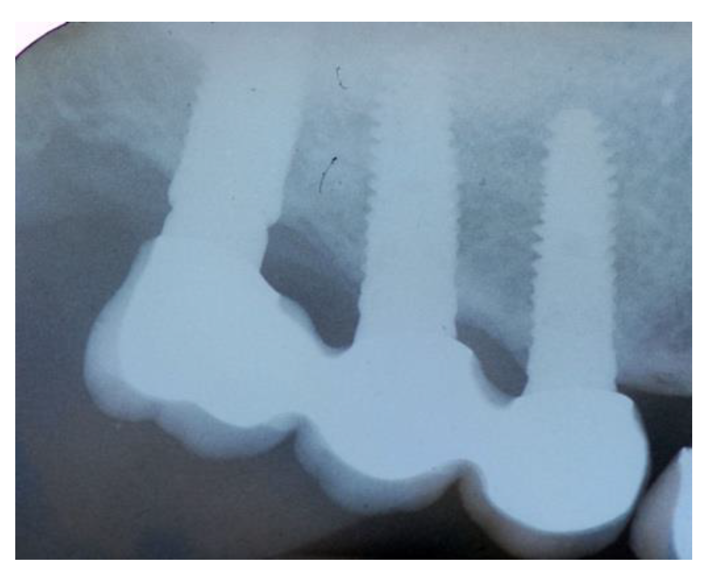 Jcm 11 02491 g020 Jcm 11 02491 g020