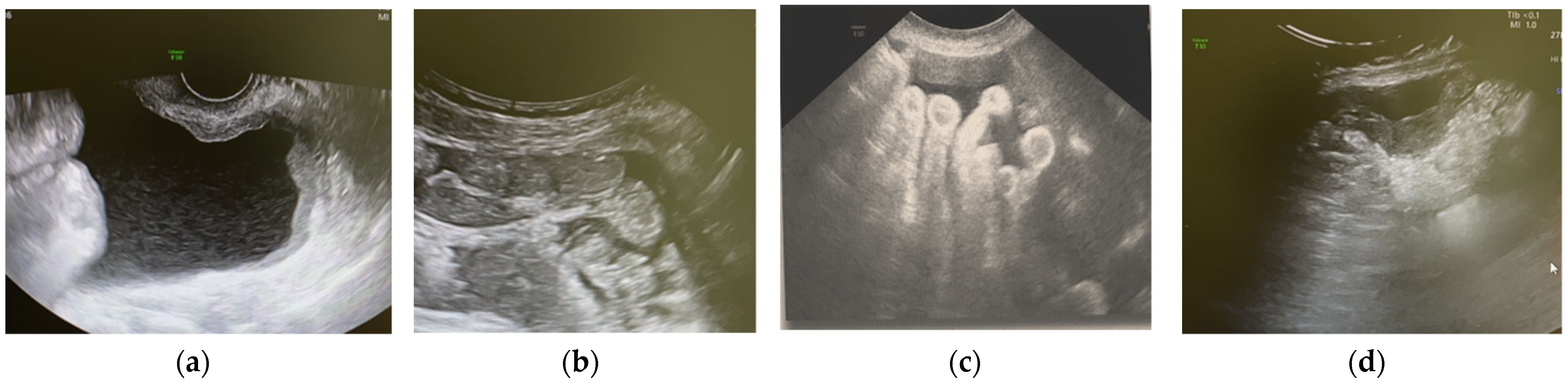 Jcm 11 02534 g004