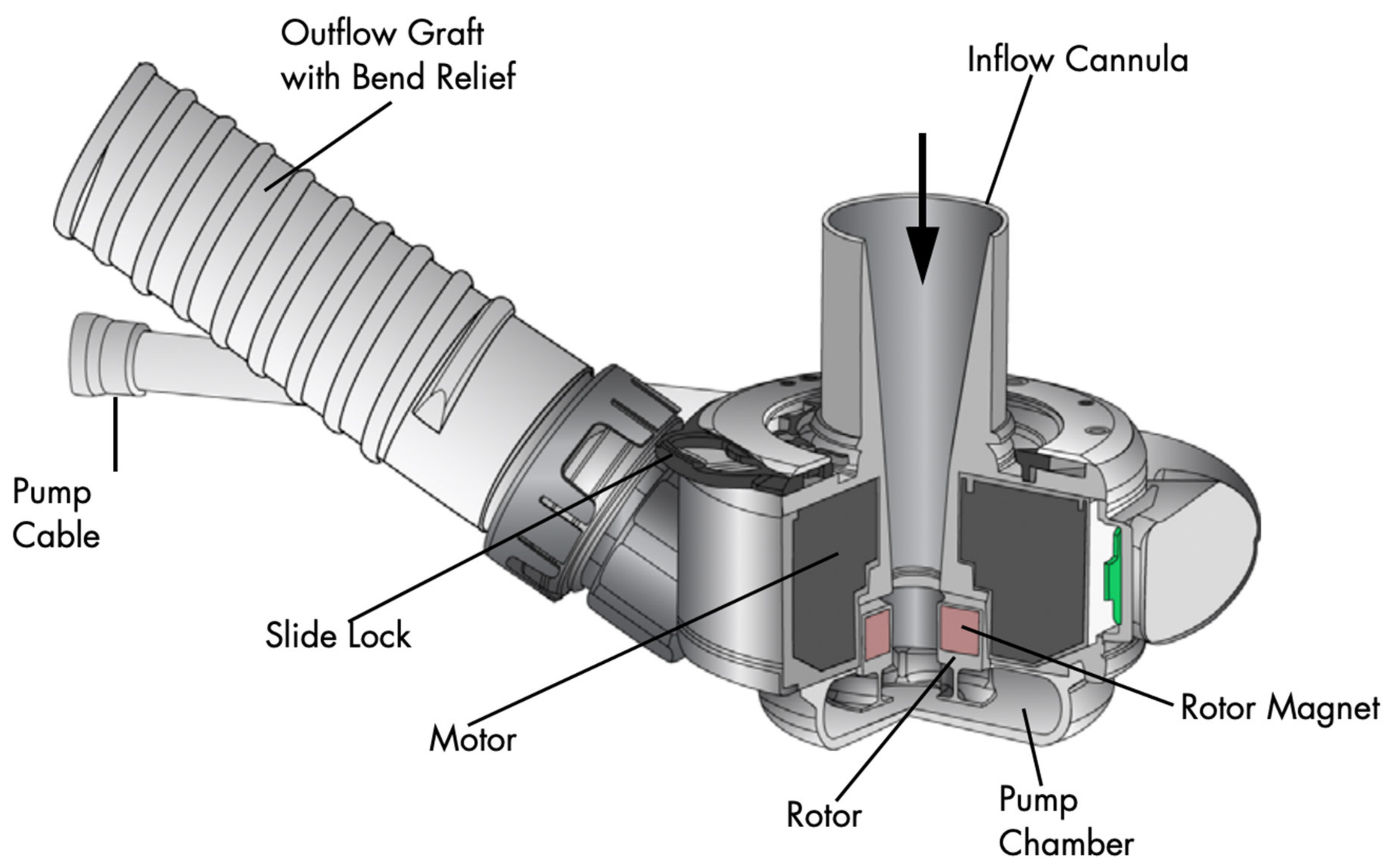 Left Ventricular Assist Devices: A Primer For the General Cardiologist