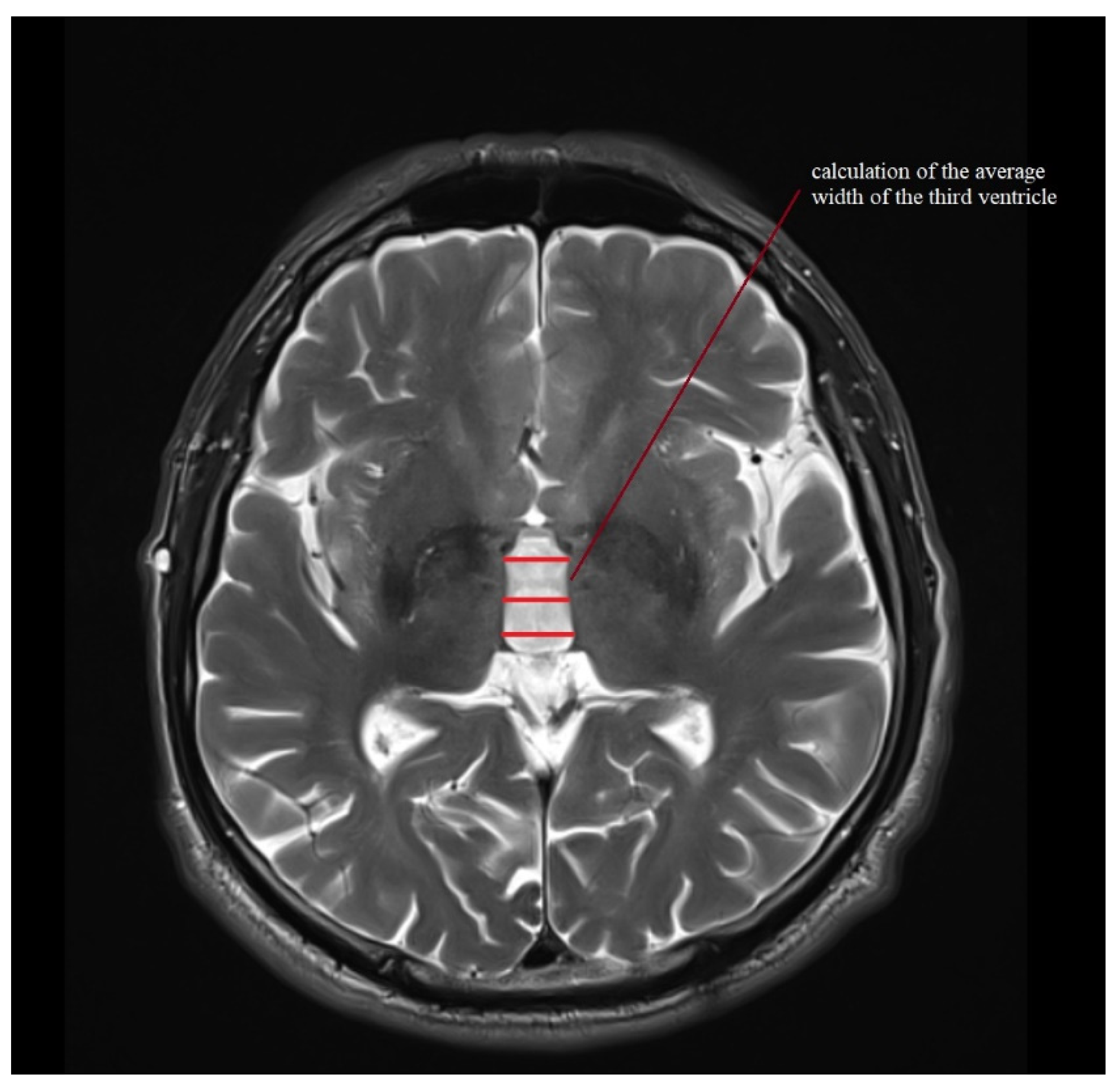 Jcm 11 02701 g005 Jcm 11 02701 g005