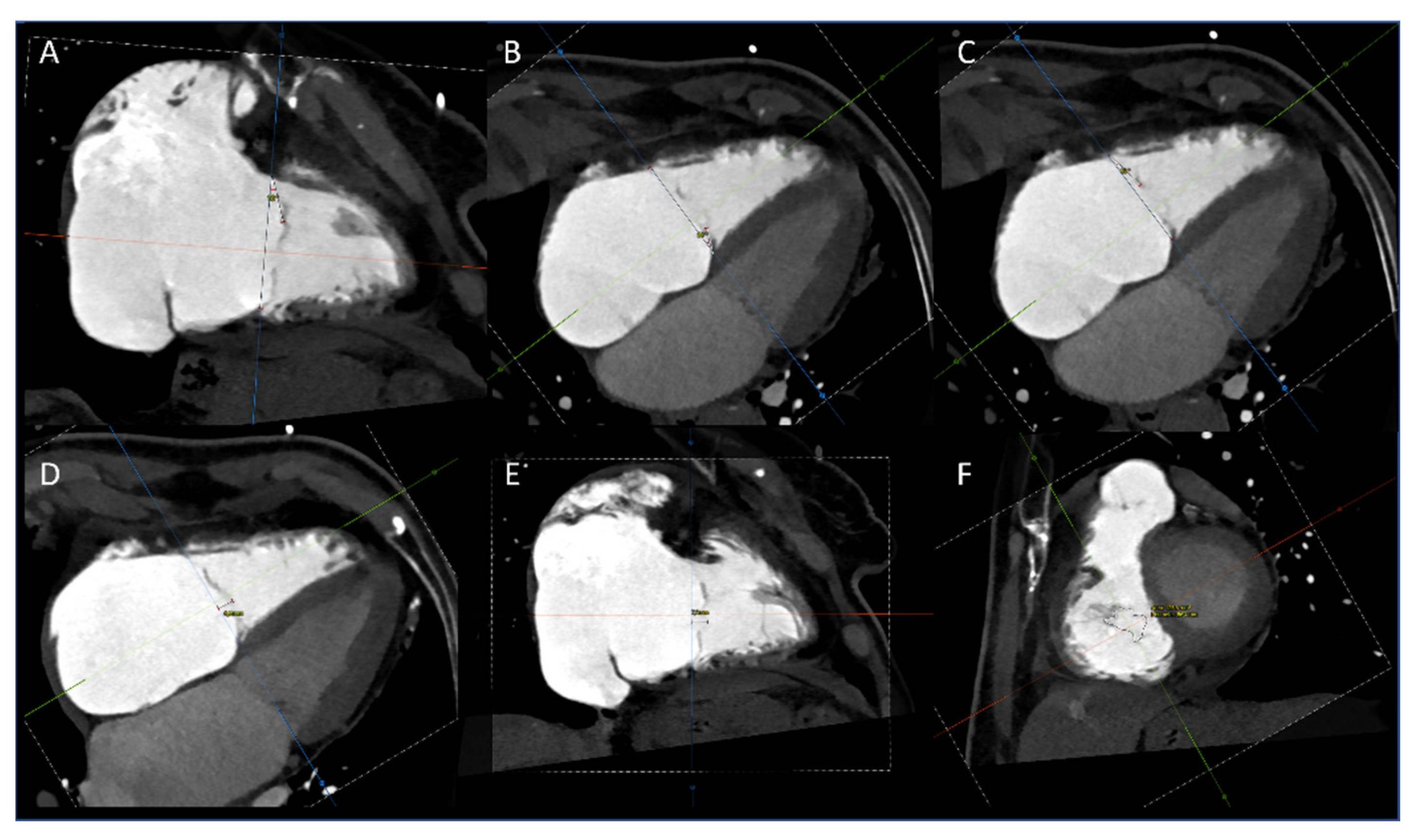 Jcm 11 02825 g002 Jcm 11 02825 g002