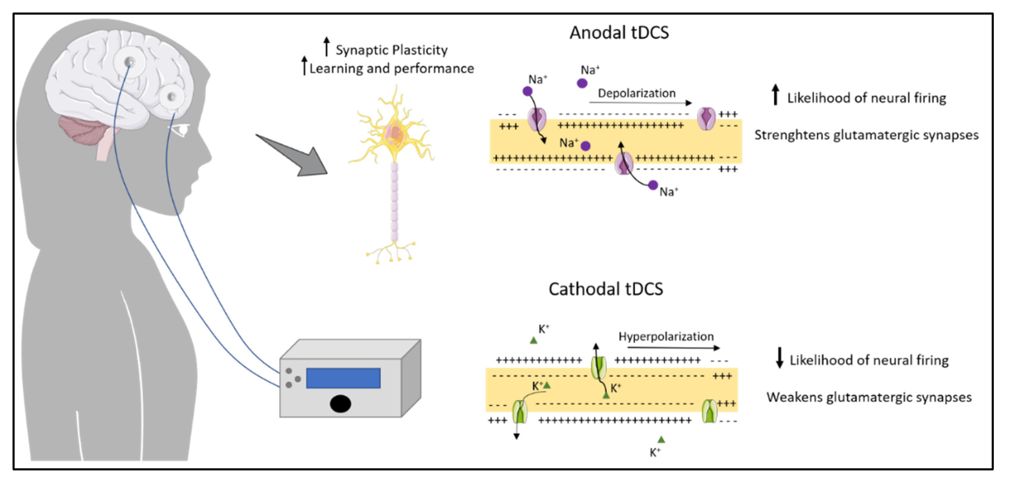 Transcranial direct current stimulation (tDCS) combined with cognitive  training in adolescent boys with ADHD: a double-blind, randomised,  sham-controlled trial, Psychological Medicine