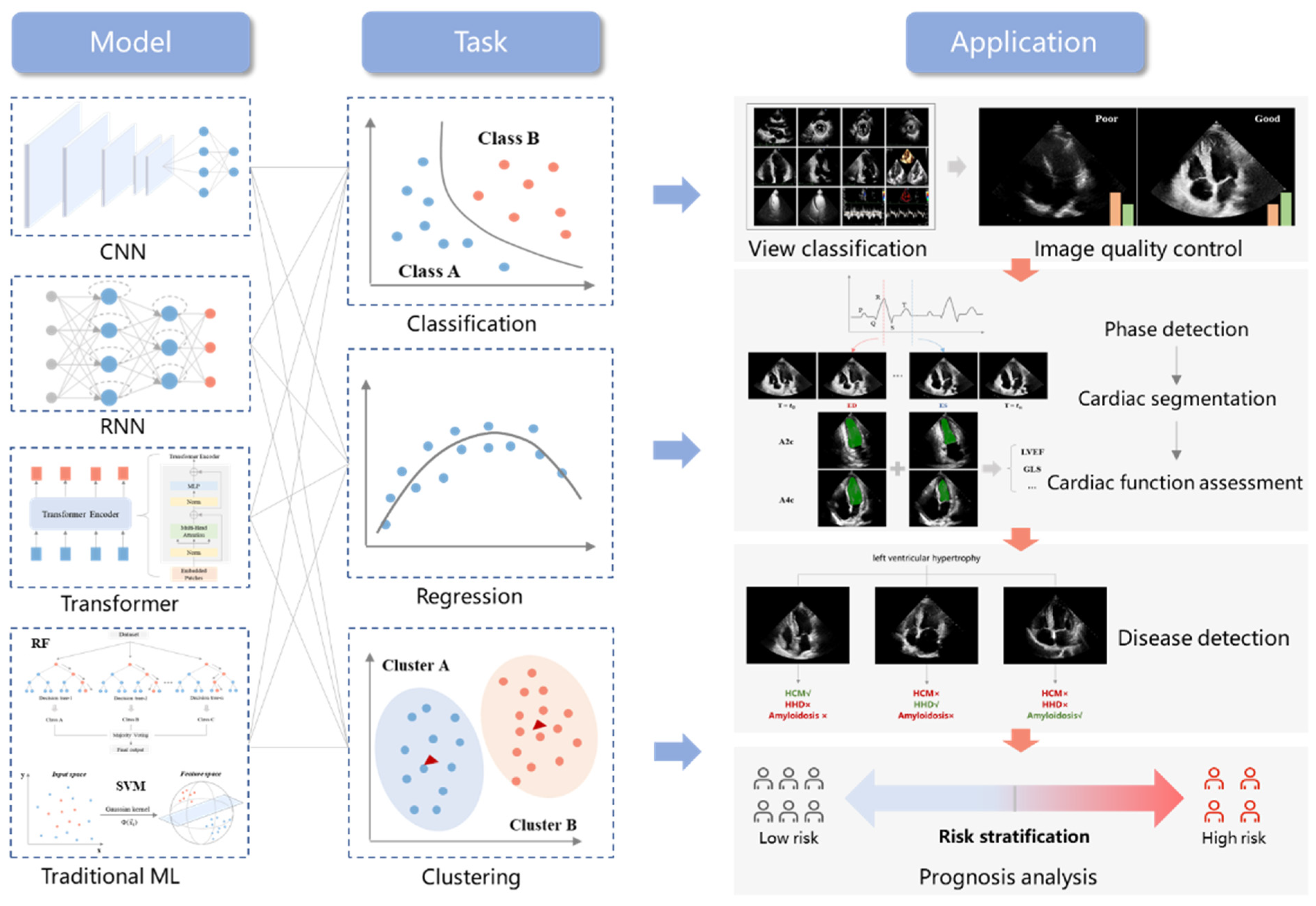 The EchoWeb - Patient Diagnosed with LV Diastolic Dysfunction and Reduced  EF 