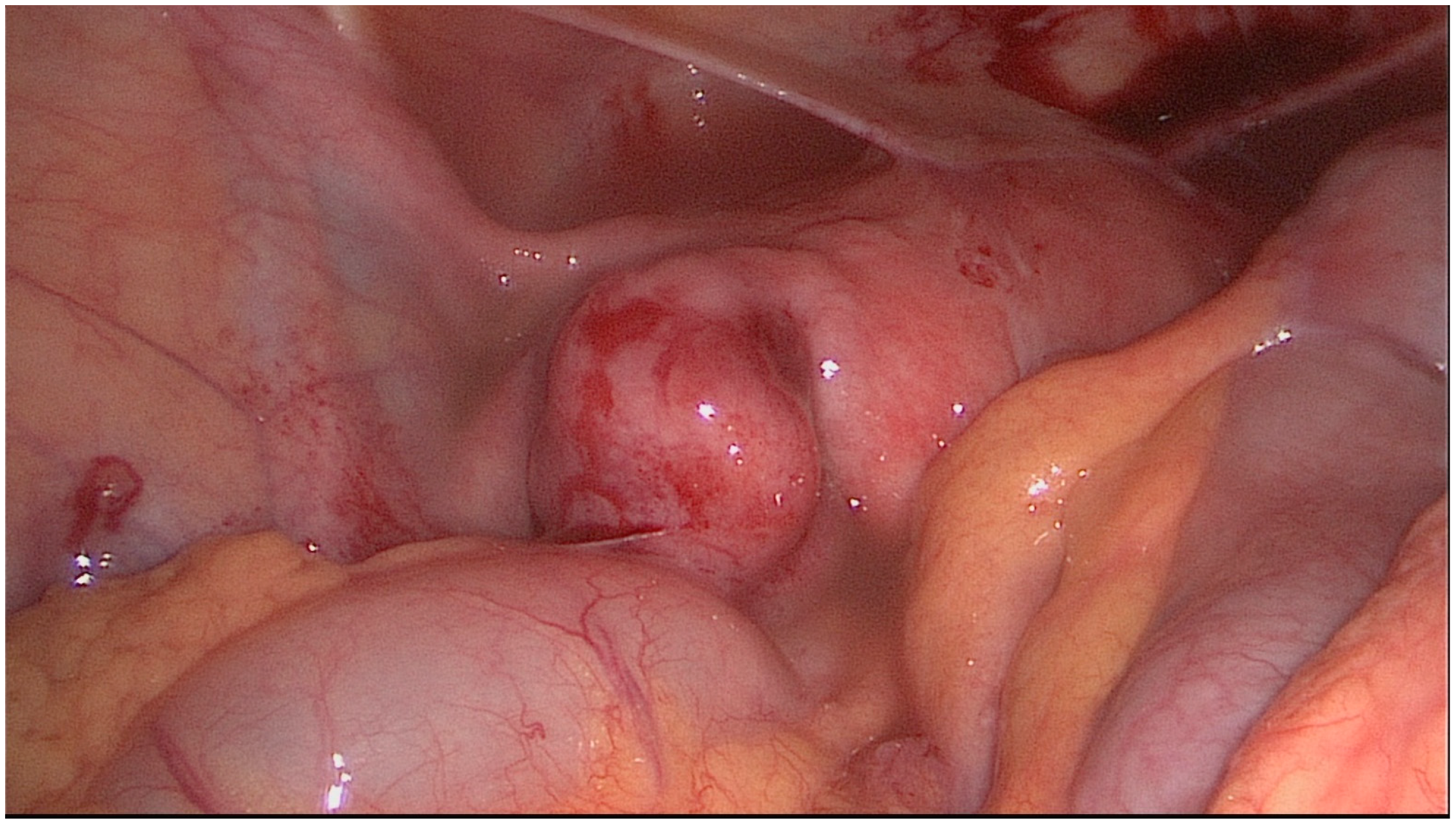 Jcm 11 03278 g002 Jcm 11 03278 g002