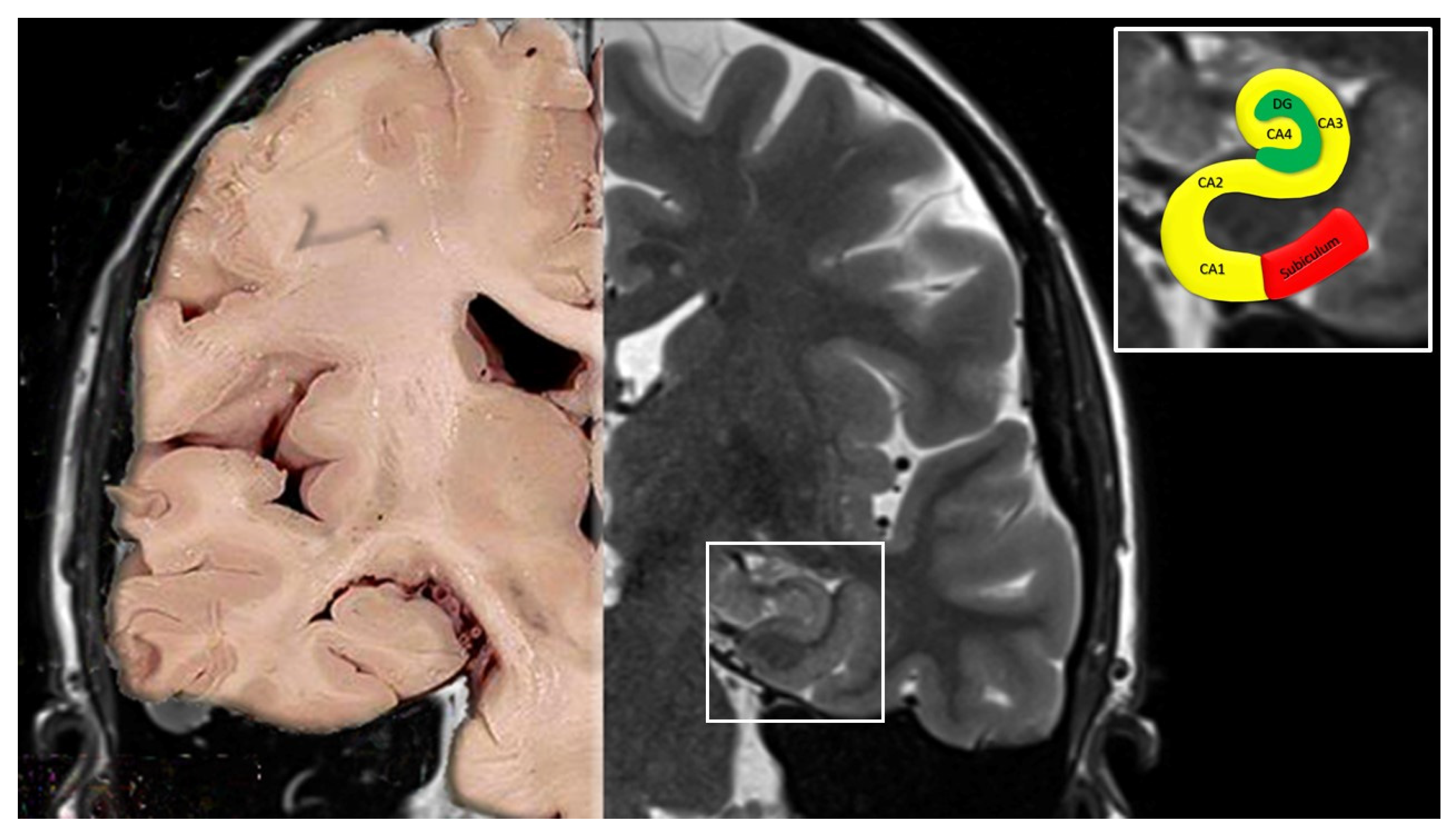 Jcm 11 03373 g002 Jcm 11 03373 g002
