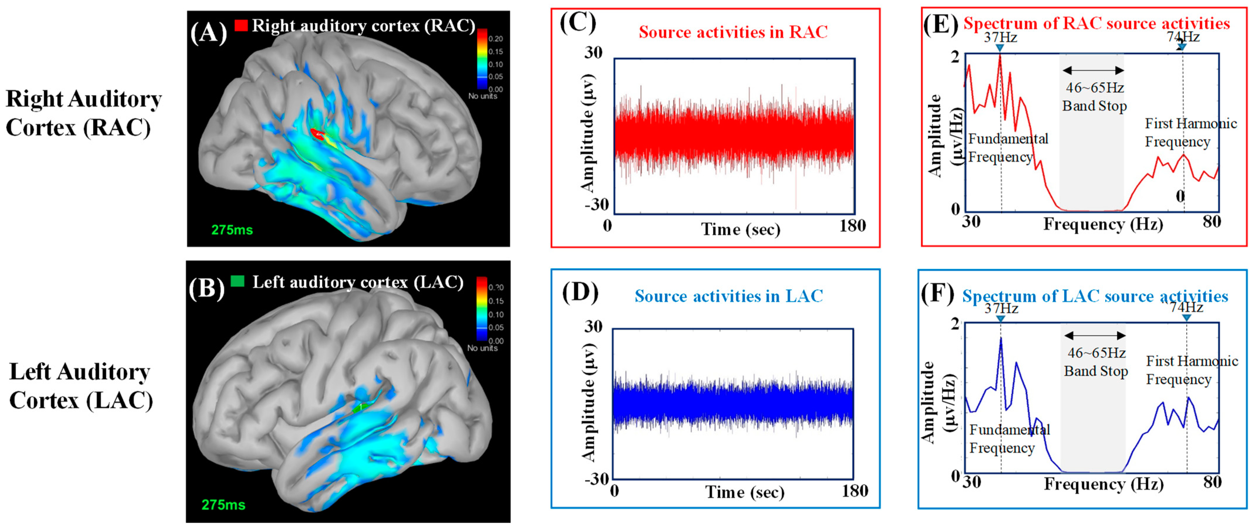 PDF) [Auditory steady-state response in the auditory evaluation: clinical  application]