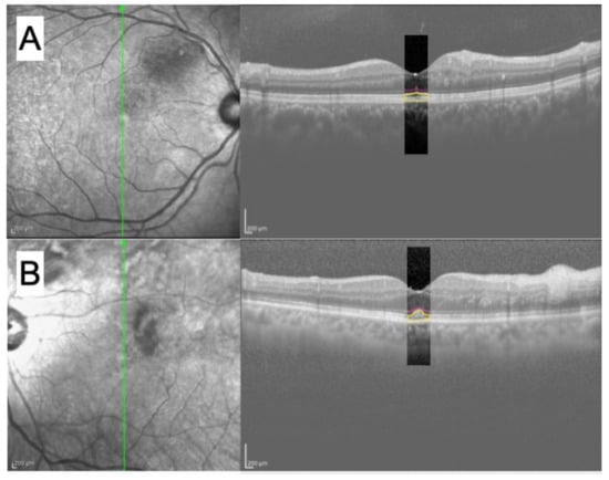 Retinal Variables - Info Visualization