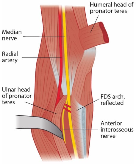 What To Do When Experiencing Nerve Pain After Surgery - APC