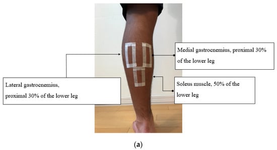 Soleus Muscle Pain, Strain or Tear: Causes & Treatment - Video & Lesson  Transcript