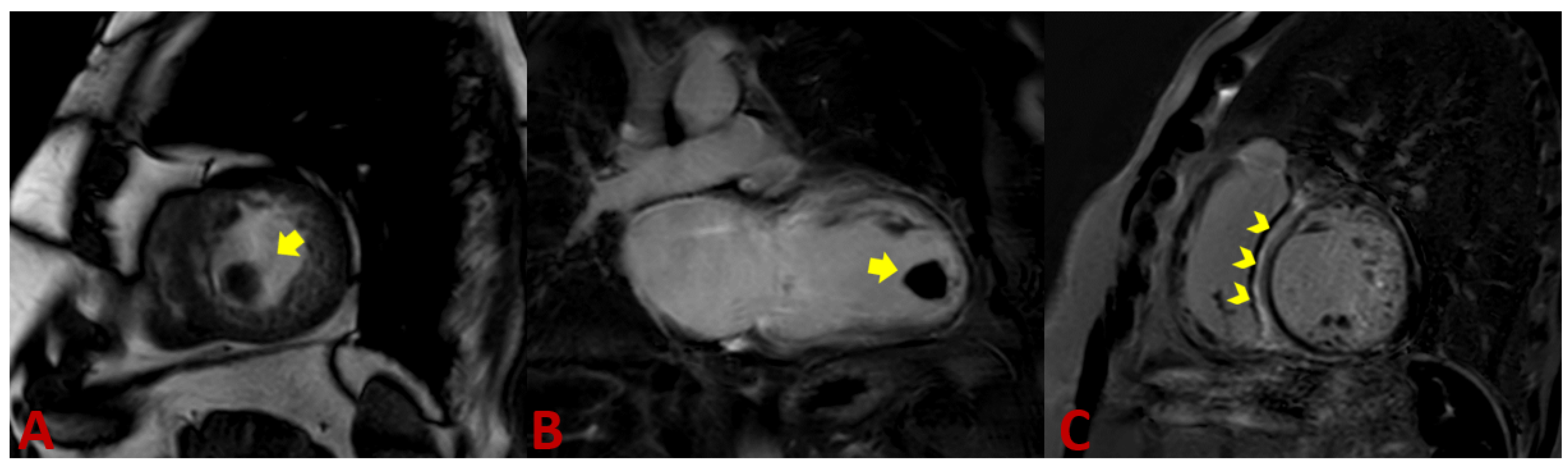 Jcm 11 04135 g004 Jcm 11 04135 g004