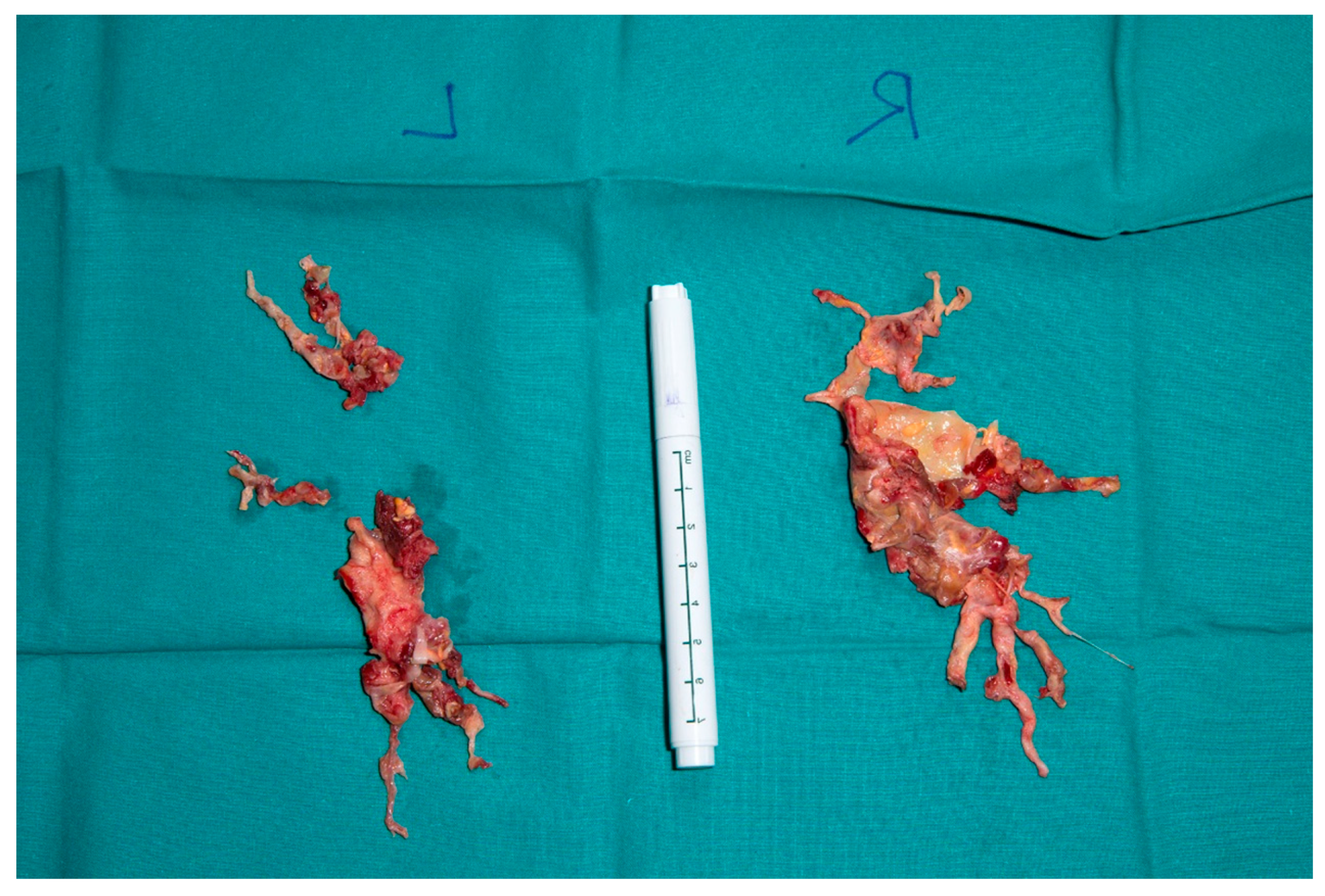 Jcm 11 04224 g005 Jcm 11 04224 g005