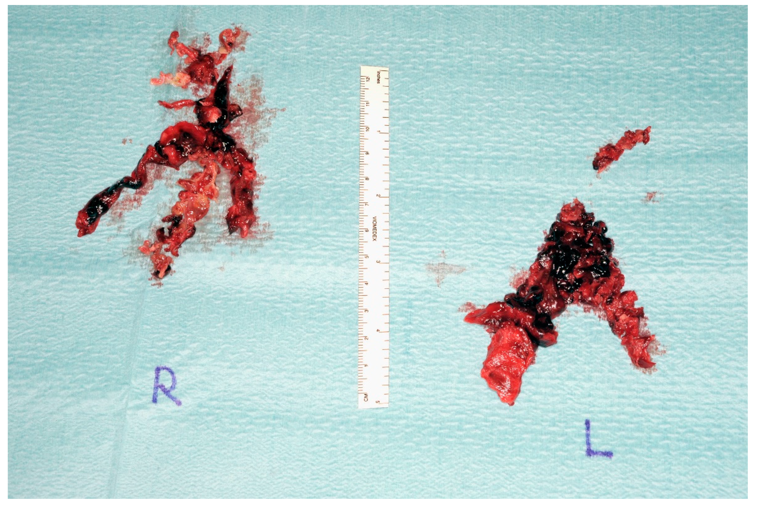 Jcm 11 04224 g008 Jcm 11 04224 g008