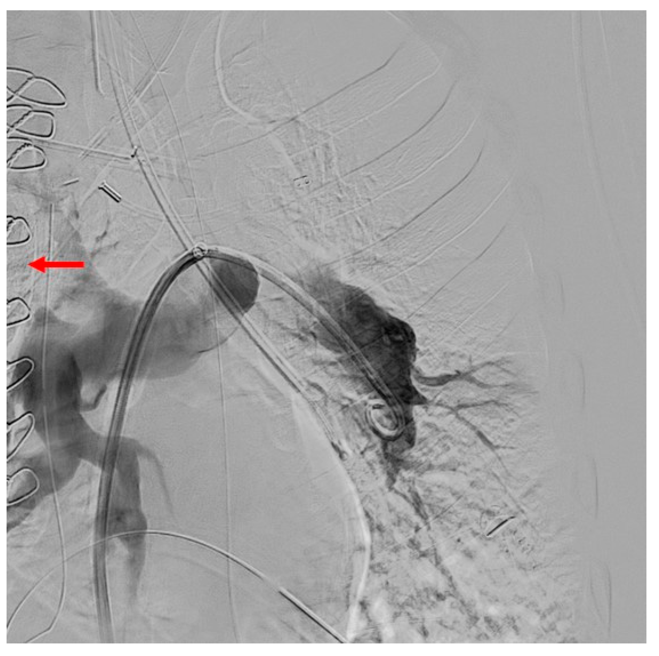 Jcm 11 04224 g009 Jcm 11 04224 g009