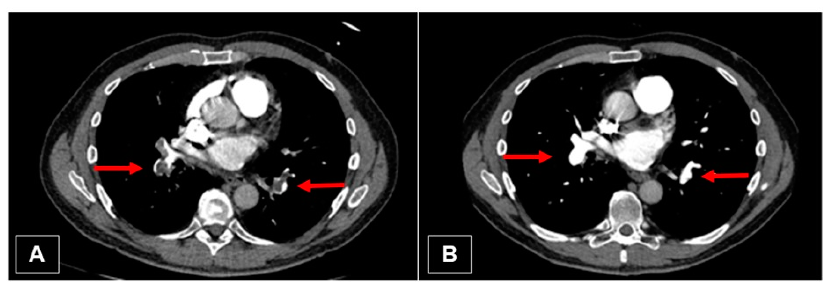 Jcm 11 04224 g010 Jcm 11 04224 g010