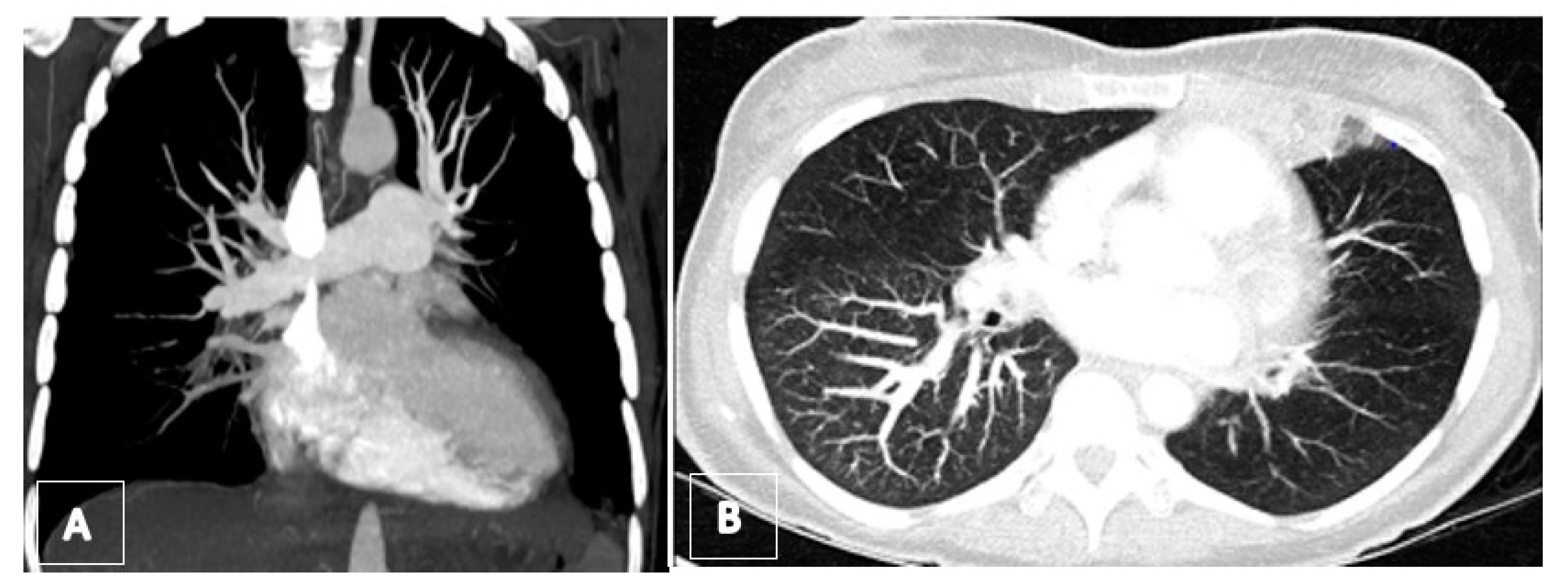 Jcm 11 04224 g011 Jcm 11 04224 g011