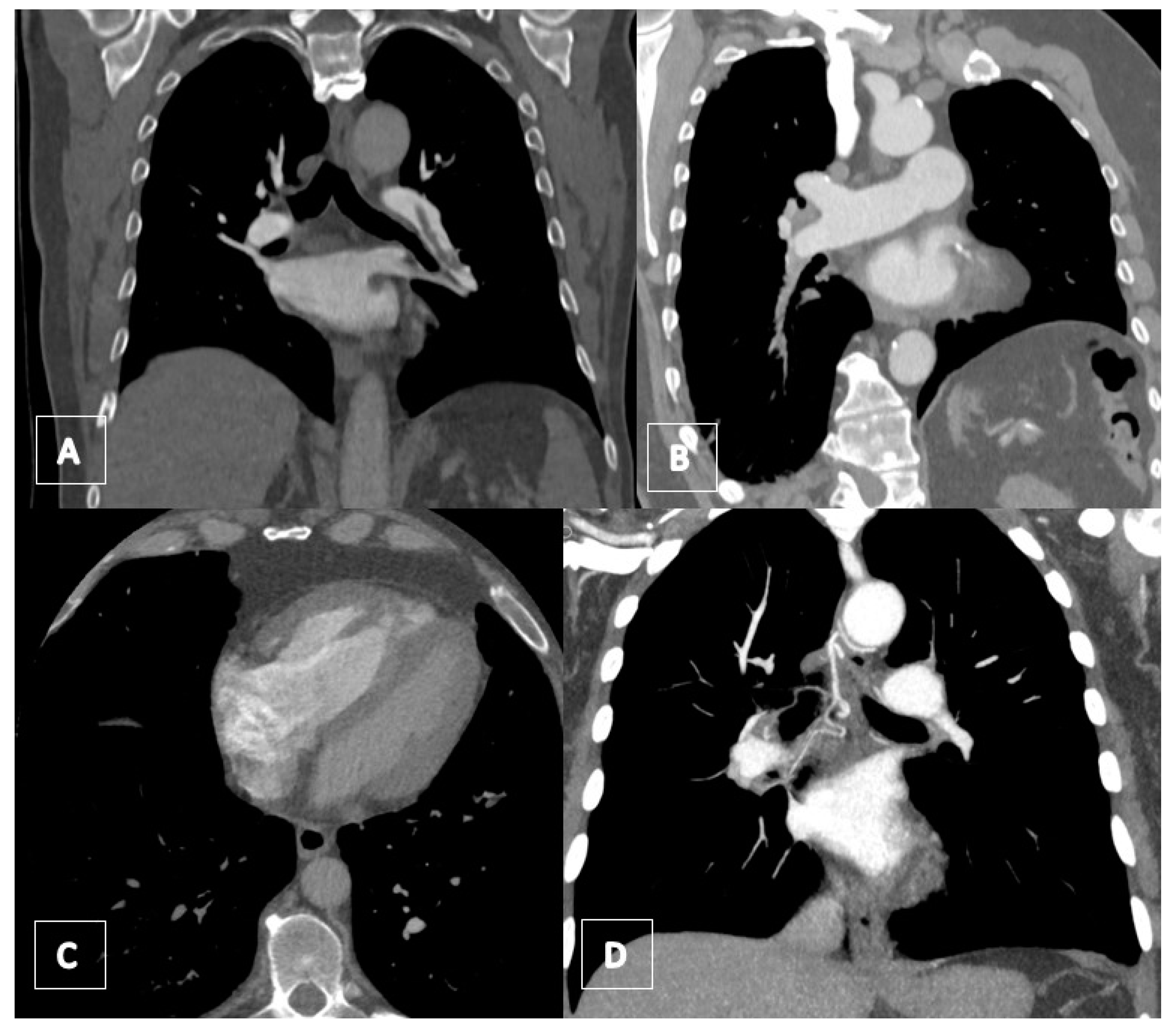 Jcm 11 04224 g015 Jcm 11 04224 g015