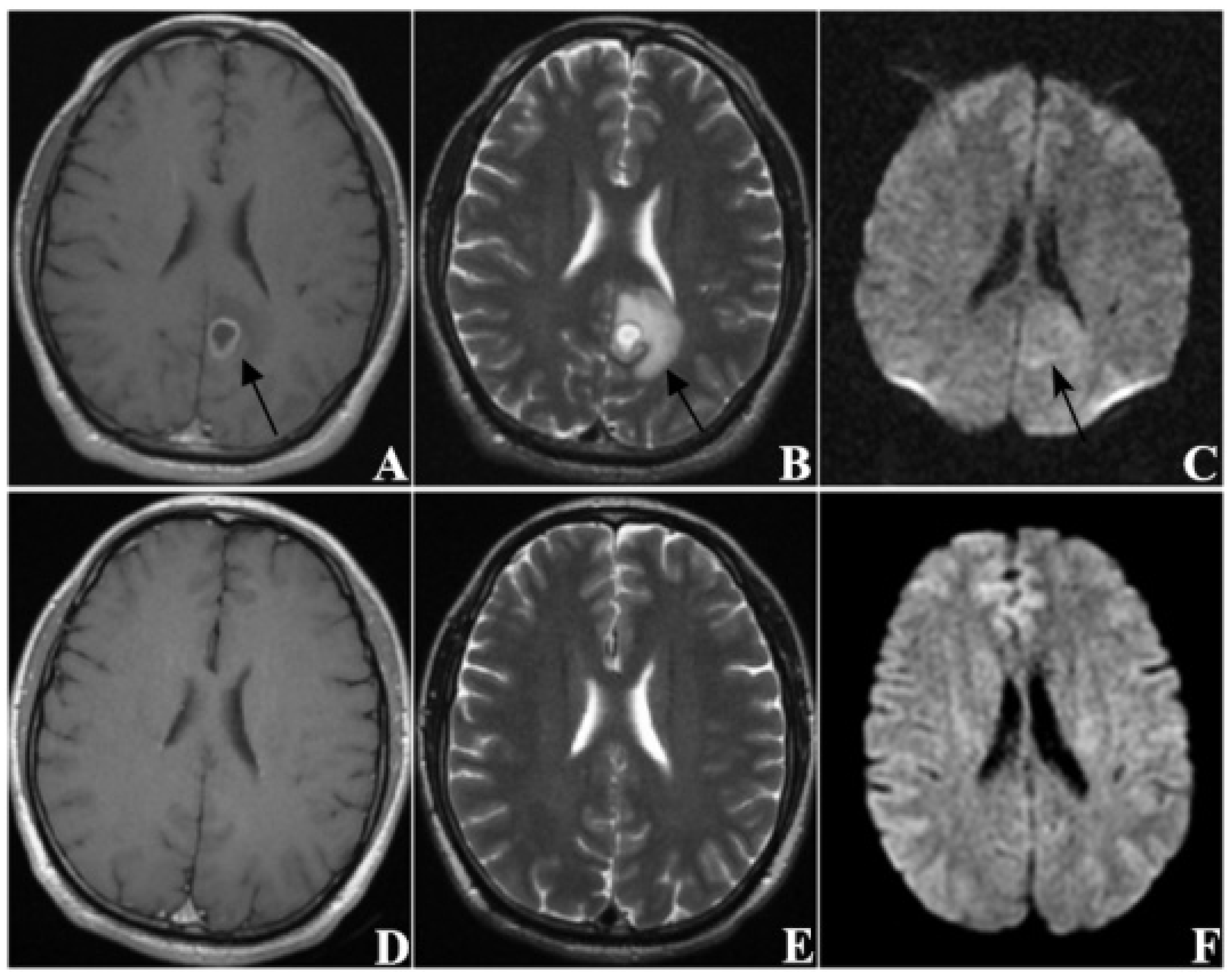 Jcm 11 04529 g004 Jcm 11 04529 g004