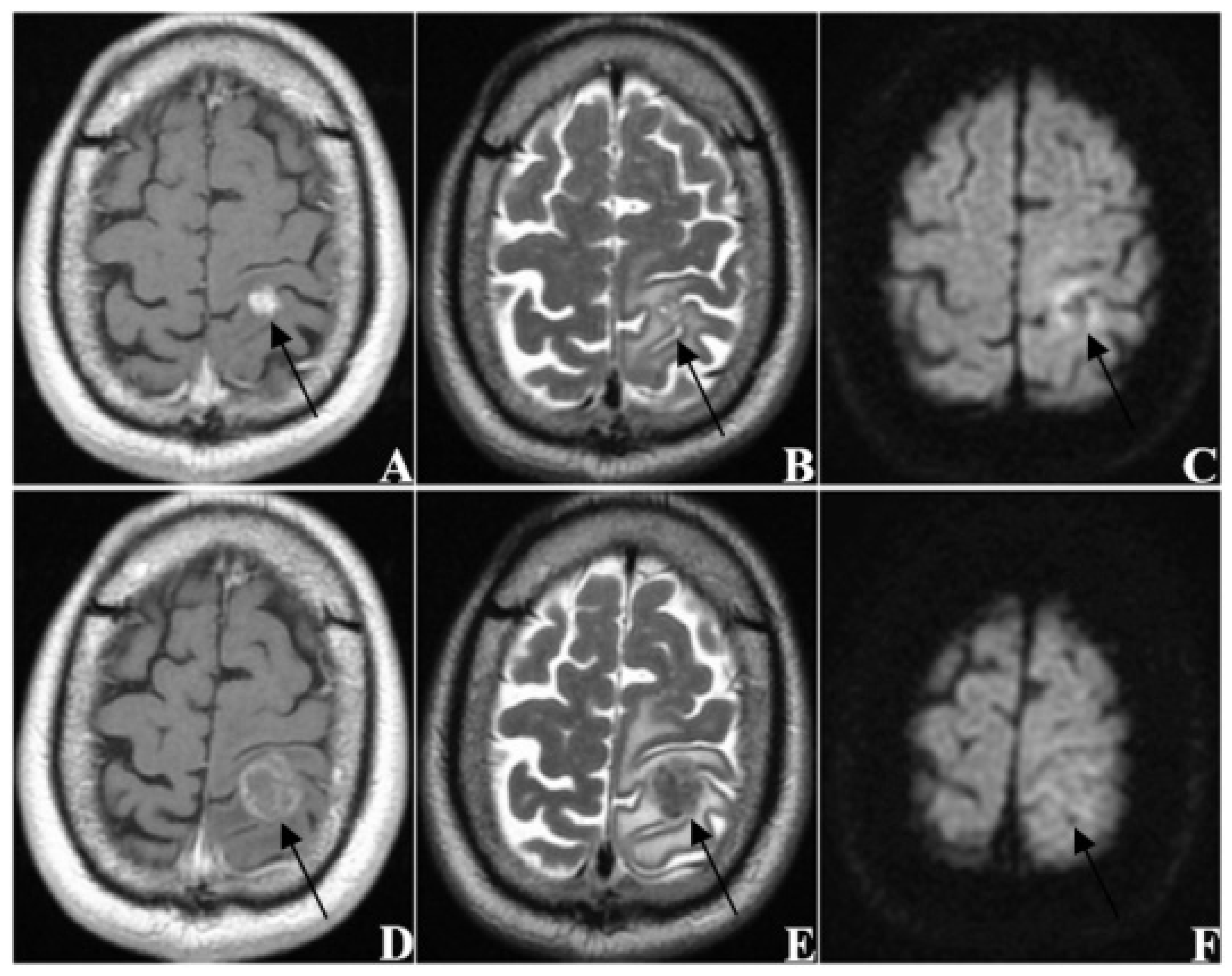Jcm 11 04529 g005 Jcm 11 04529 g005