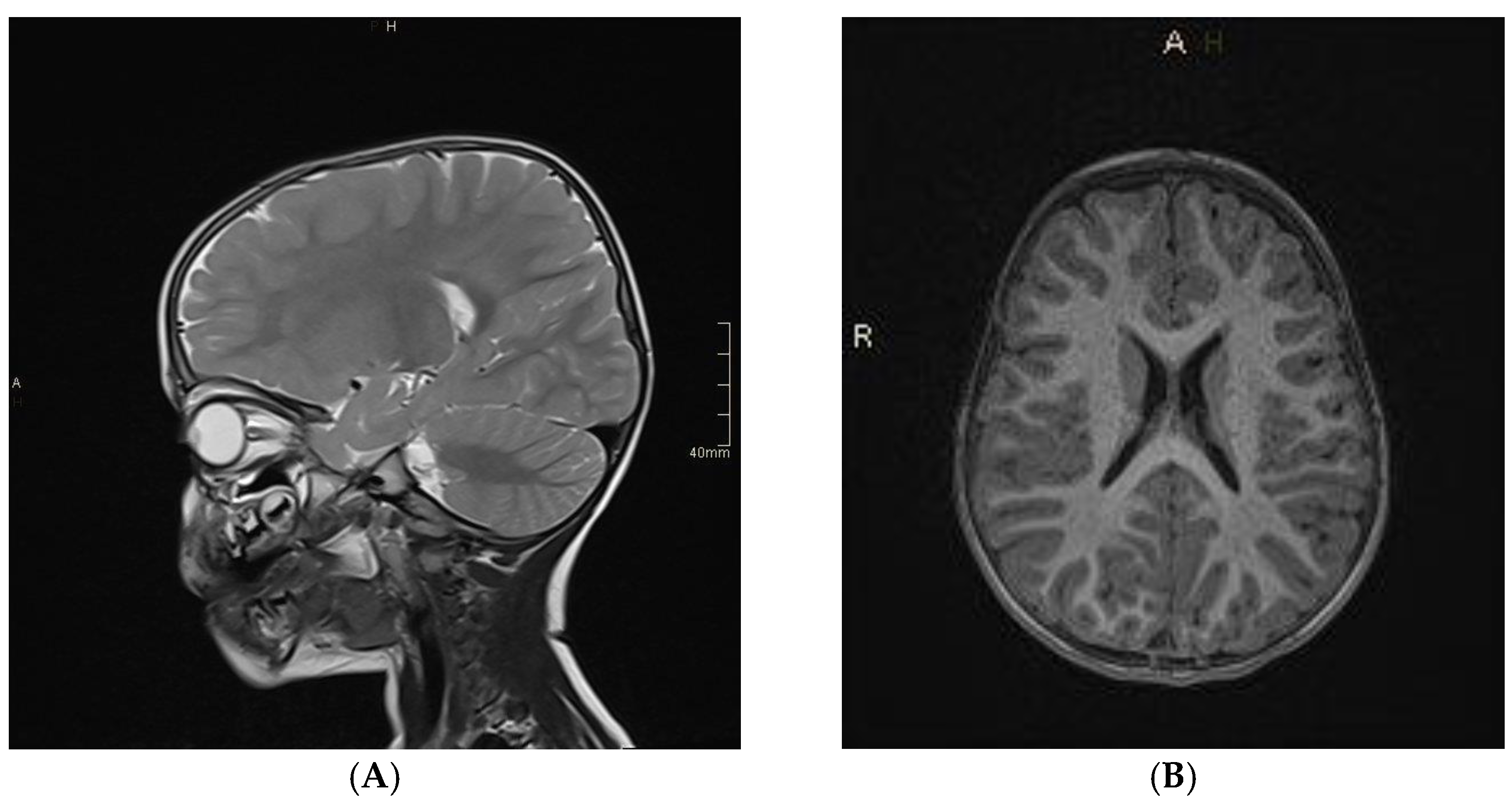 Jcm 11 04657 g002 Jcm 11 04657 g002