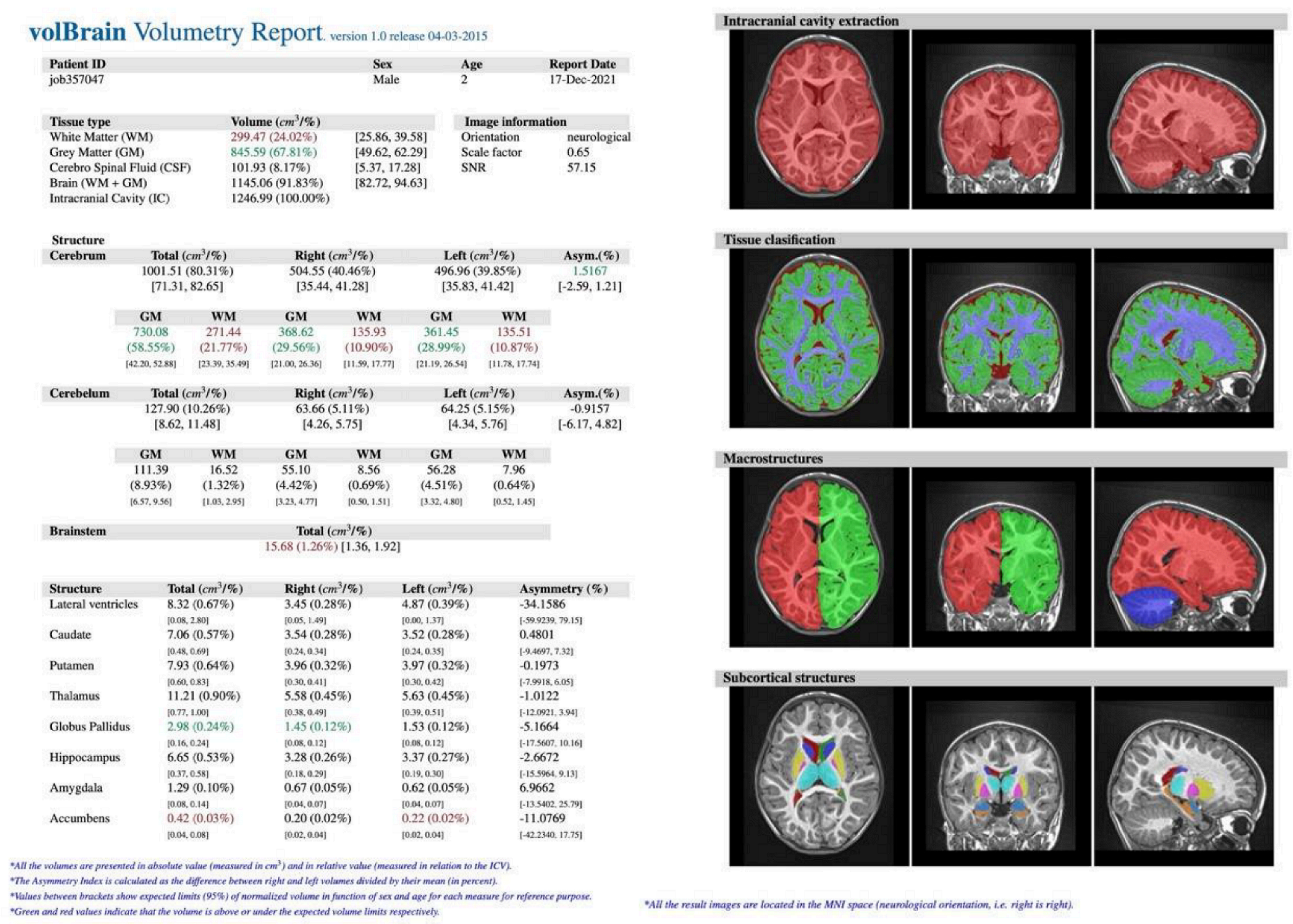Jcm 11 04657 g003 Jcm 11 04657 g003