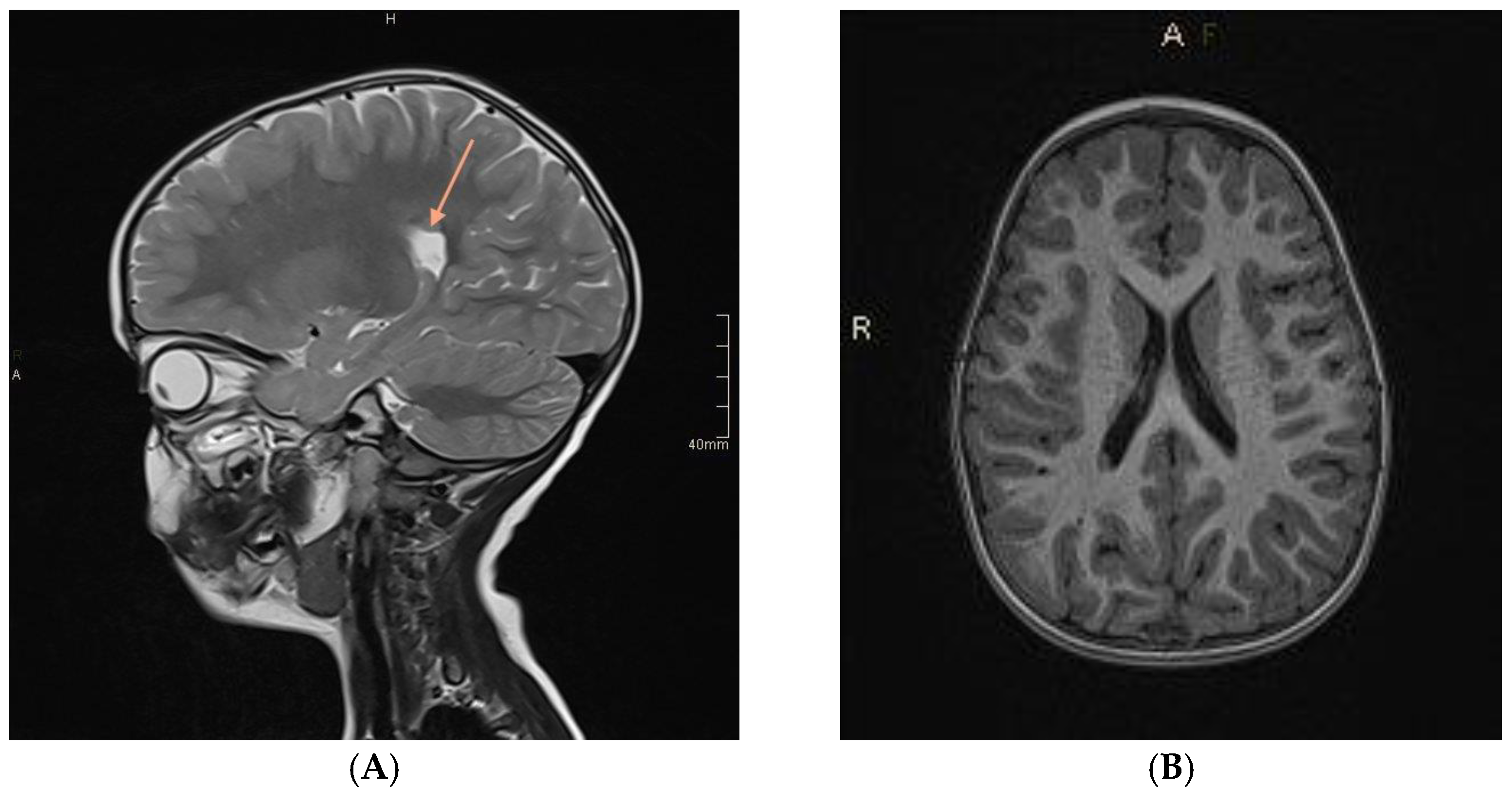 Jcm 11 04657 g004 Jcm 11 04657 g004