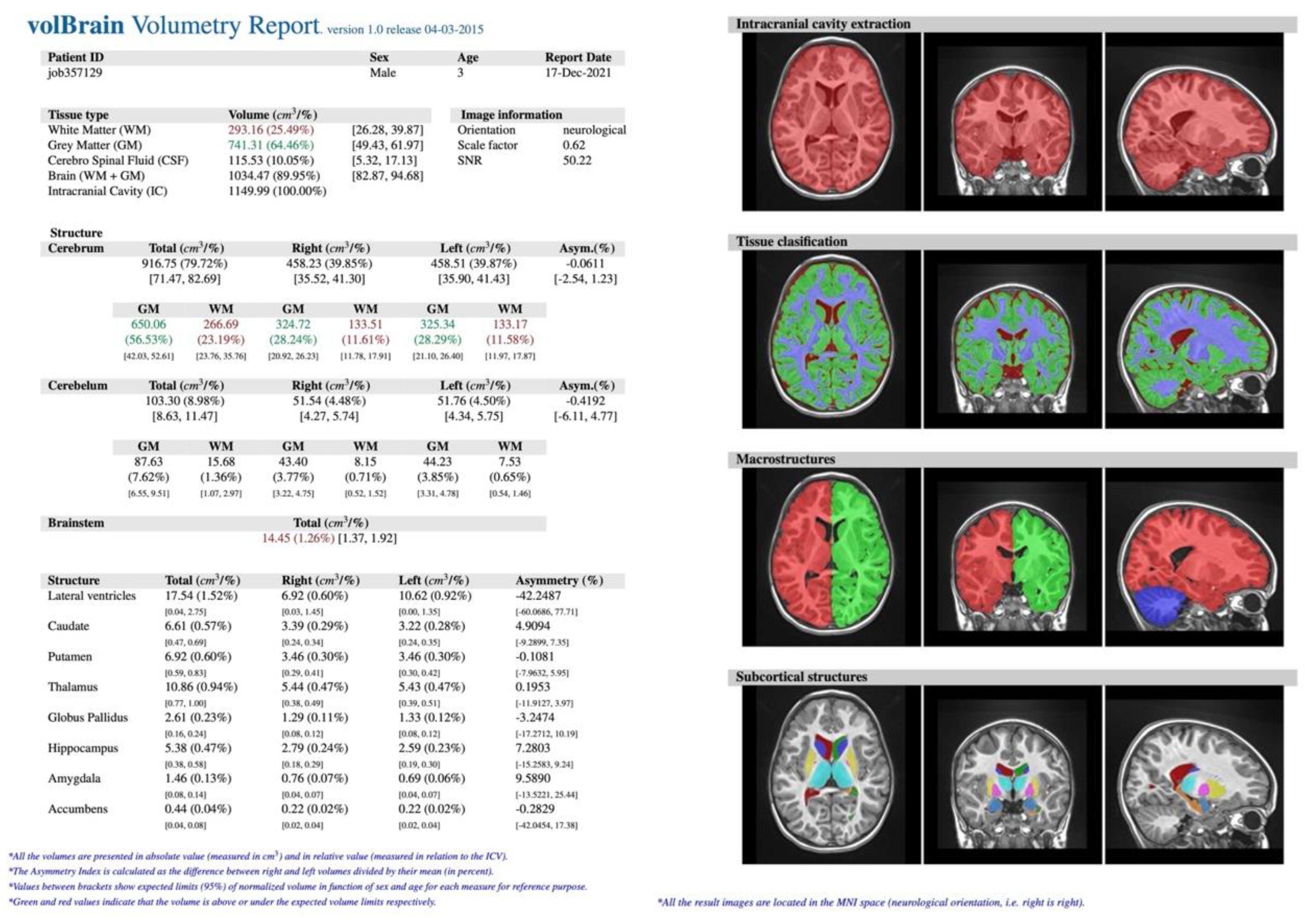 Jcm 11 04657 g005 Jcm 11 04657 g005