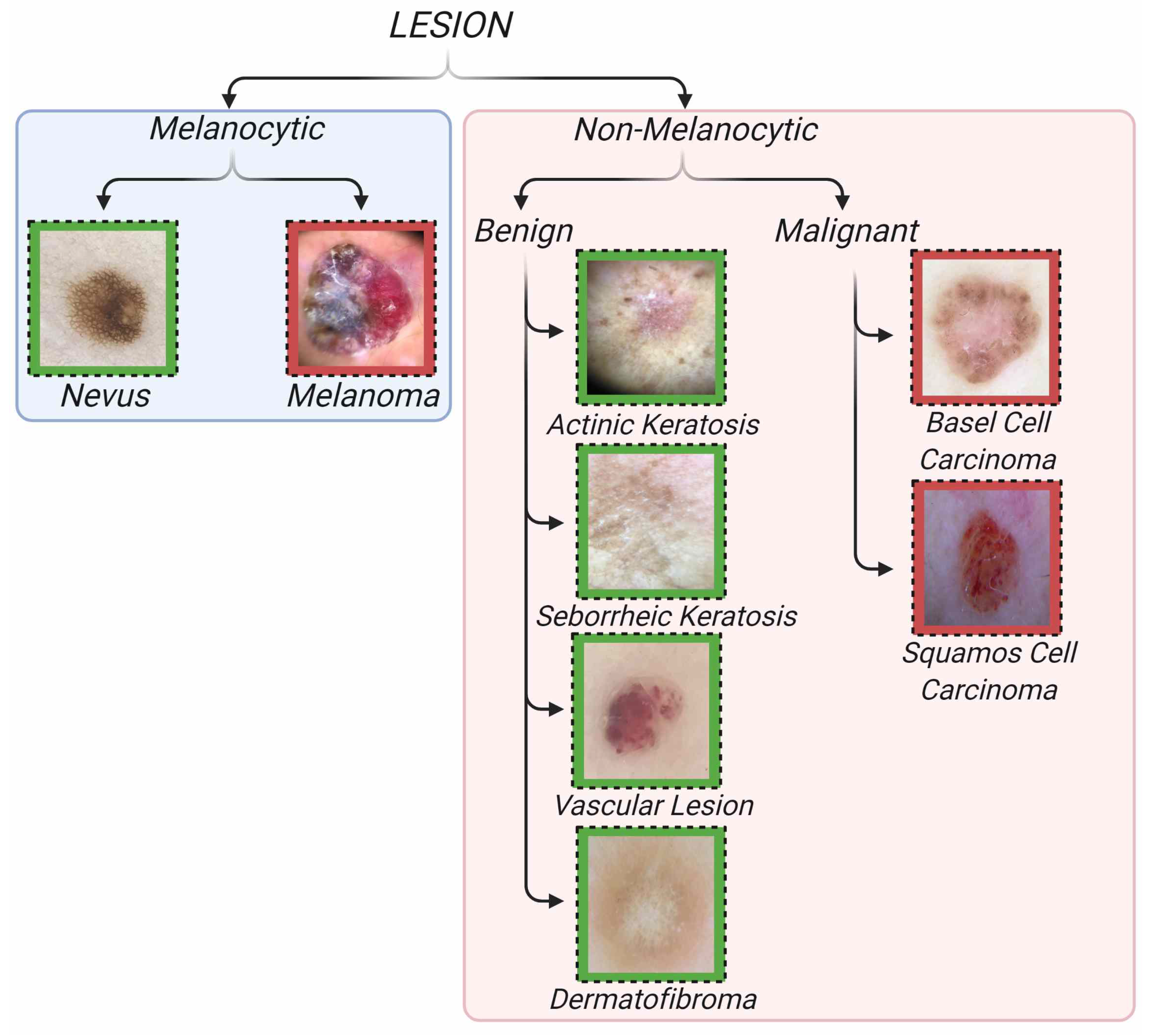A Classification System in the Massive Weight Loss Patient Based on Skin  Lesions and Activity of Daily Living