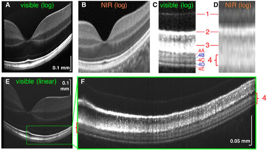 stratus optical coherence tomography