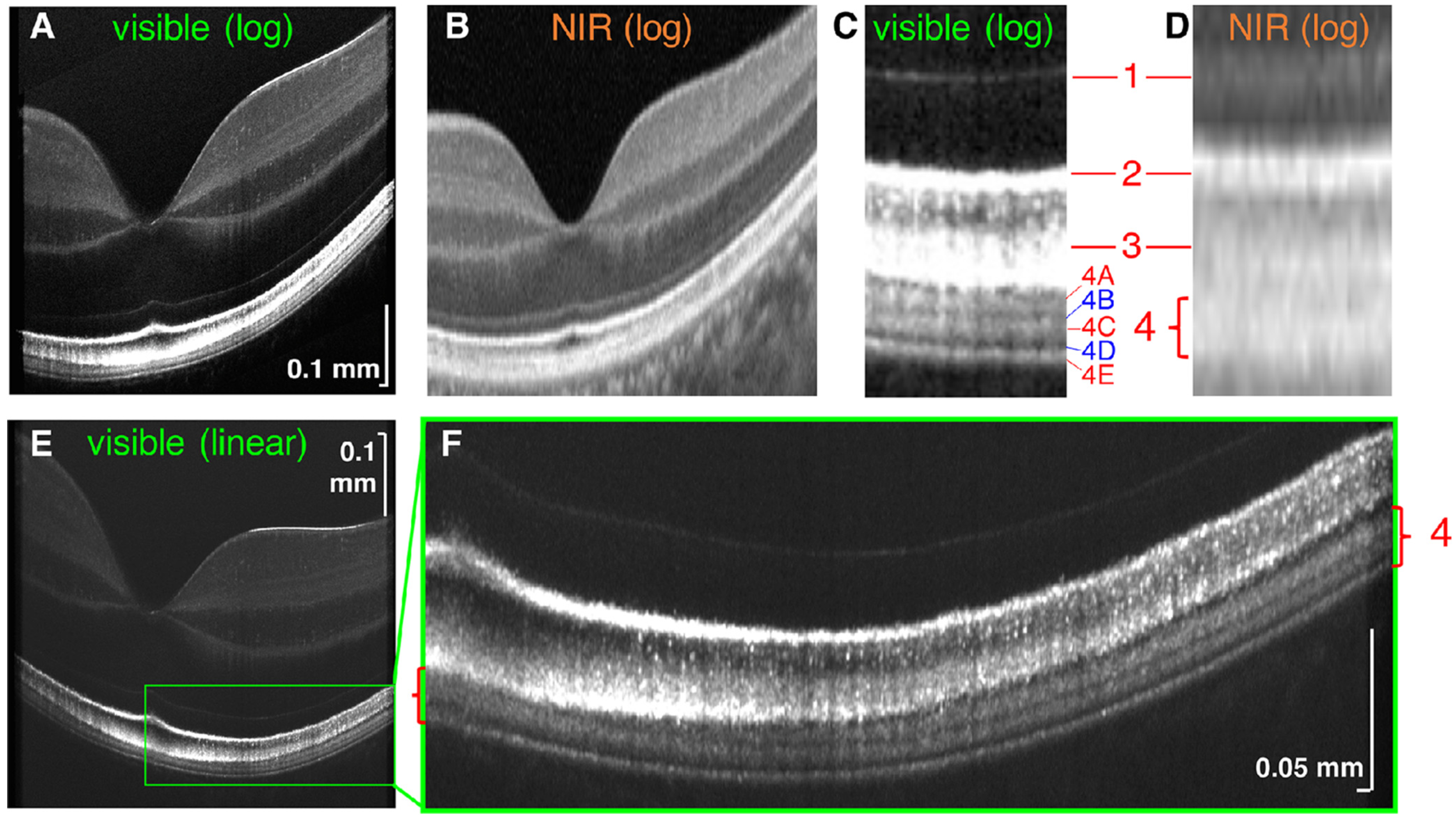 JCM | Free Full-Text | Advances in Optical Coherence Tomography Imaging  Technology and Techniques for Choroidal and Retinal Disorders | HTML